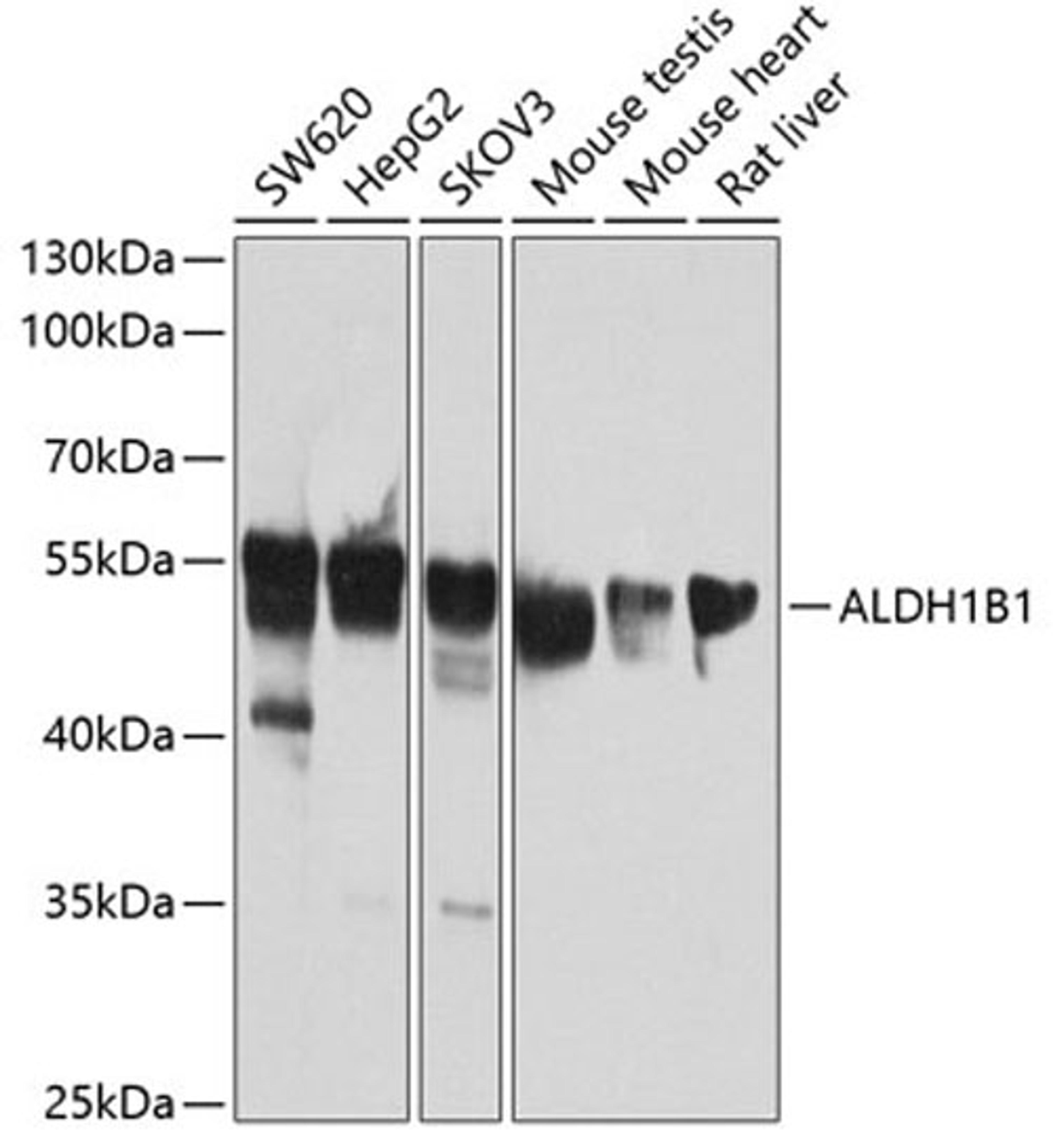 Western blot - ALDH1B1 antibody (A3725)