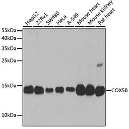 Western blot - COX5B antibody (A2640)