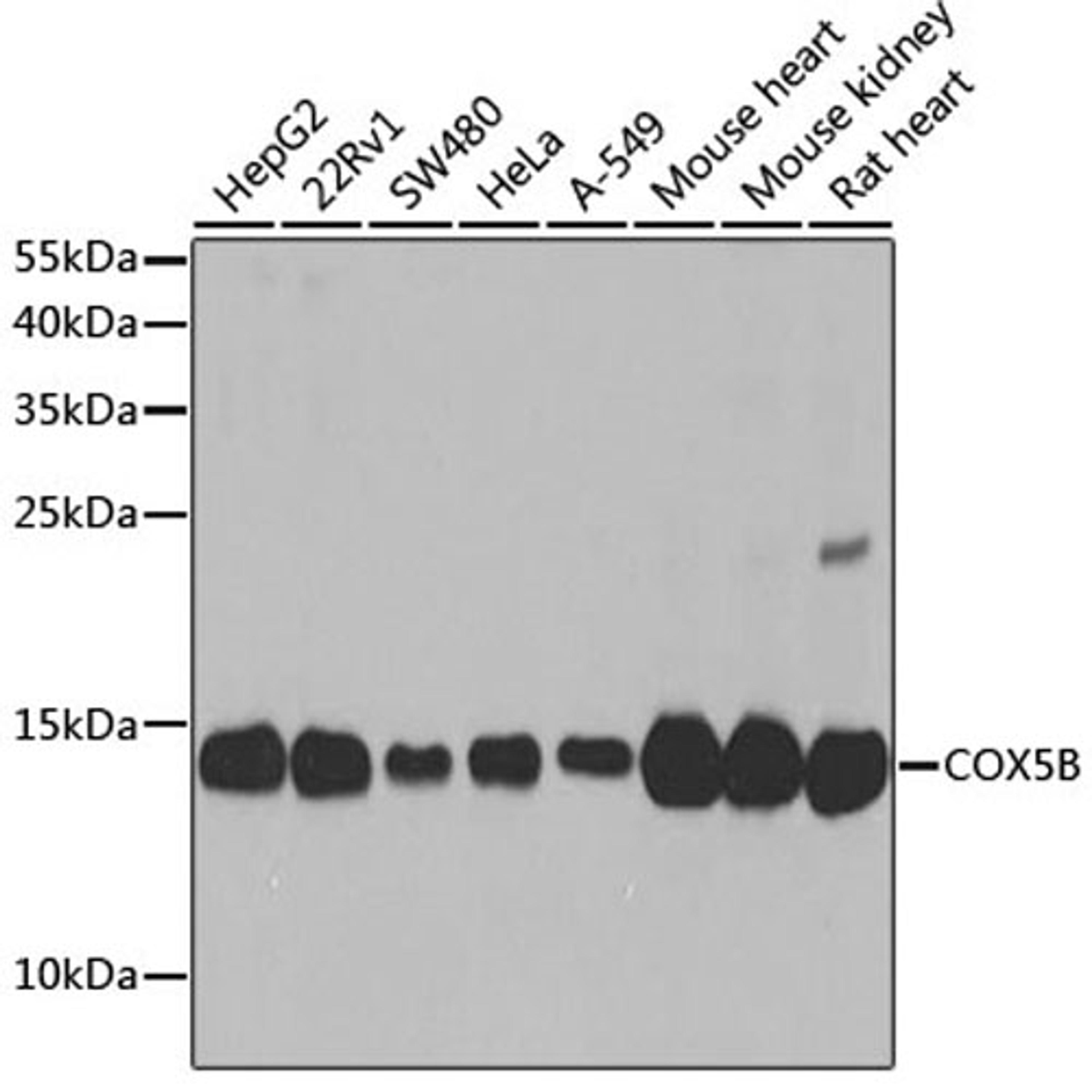 Western blot - COX5B antibody (A2640)