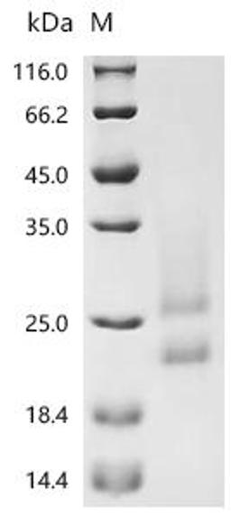 (Tris-Glycine gel) Discontinuous SDS-PAGE (reduced) with 5% enrichment gel and 15% separation gel.