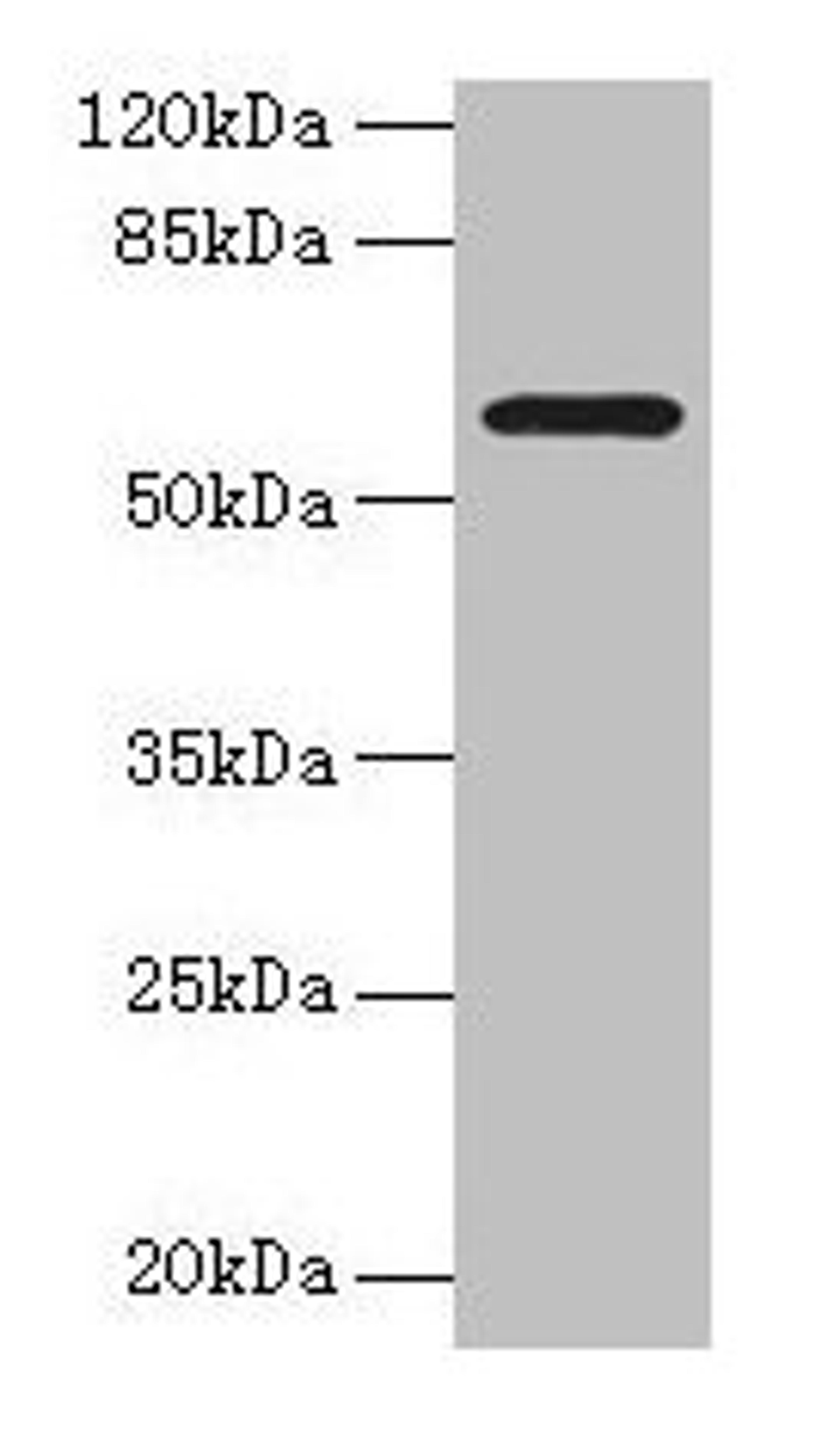 Western blot. All lanes: MAOA antibody at 1µg/ml + HepG2 whole cell lysate. Secondary. Goat polyclonal to rabbit IgG at 1/10000 dilution. Predicted band size: 60, 45 kDa. Observed band size: 60 kDa