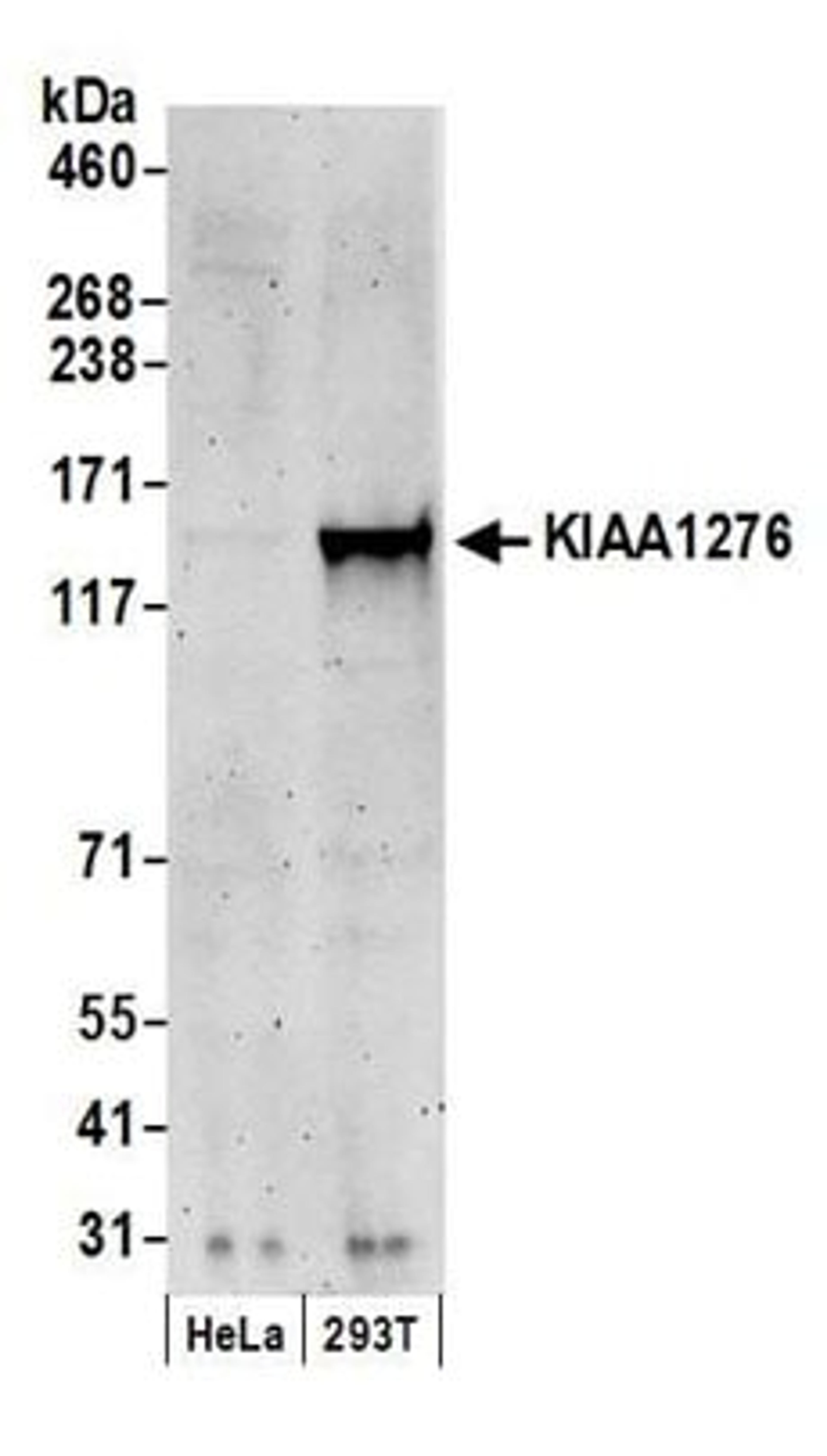 Detection of human KIAA1276 by western blot.