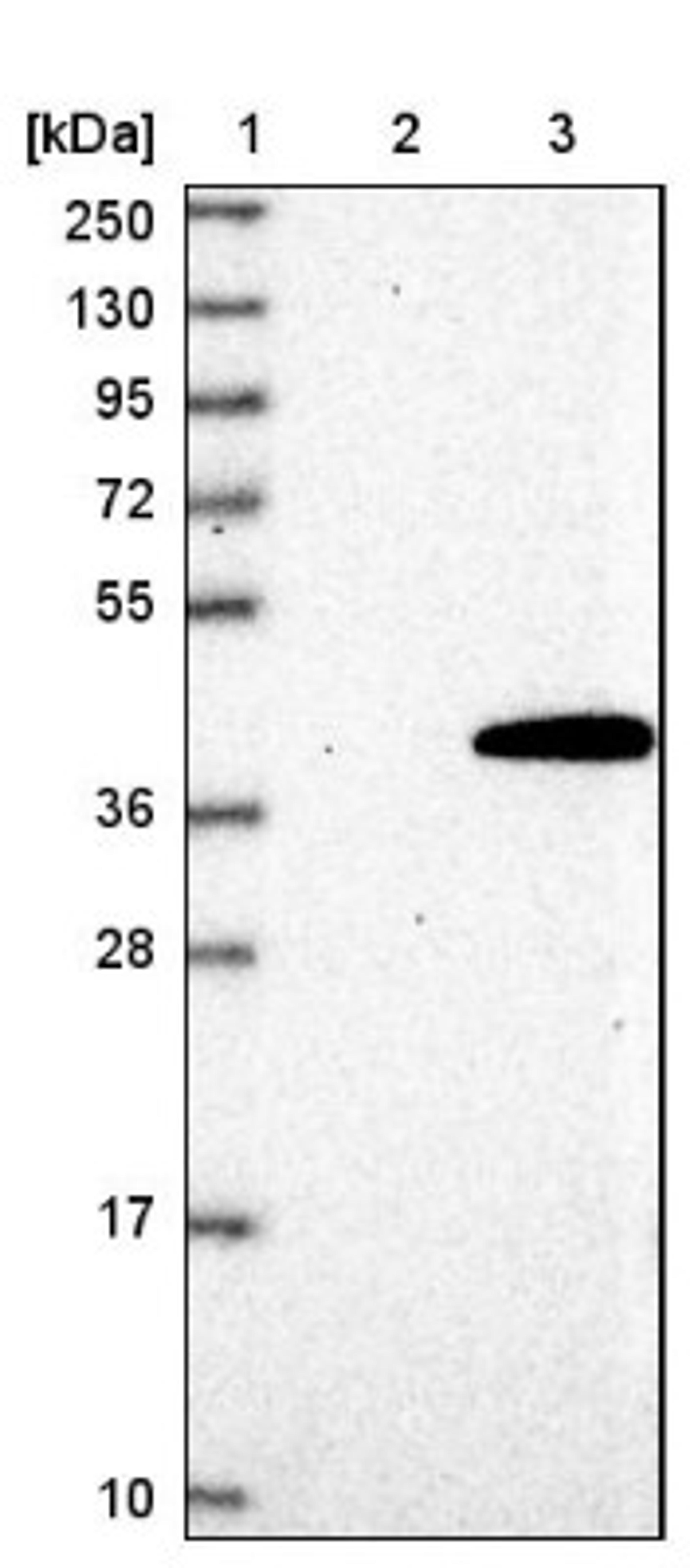 Western Blot: HSU79274 Antibody [NBP2-47426] - Lane 1: Marker [kDa] 250, 130, 95, 72, 55, 36, 28, 17, 10.  Lane 2: Negative control (vector only transfected HEK293T lysate).  Lane 3: Over-expression lysate (Co-expressed with a C-terminal myc-DDK tag (~.1 kDa) in mammalian HEK293T cells).