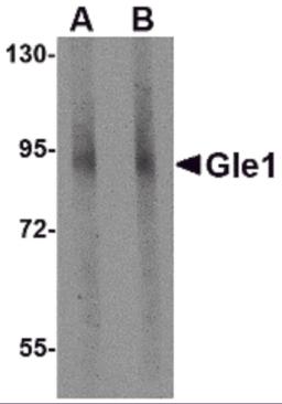 Western blot analysis of Gle1 in mouse brain tissue lysate with Gle1 antibody at (A) 1 and (B) 2 &#956;g/mL.