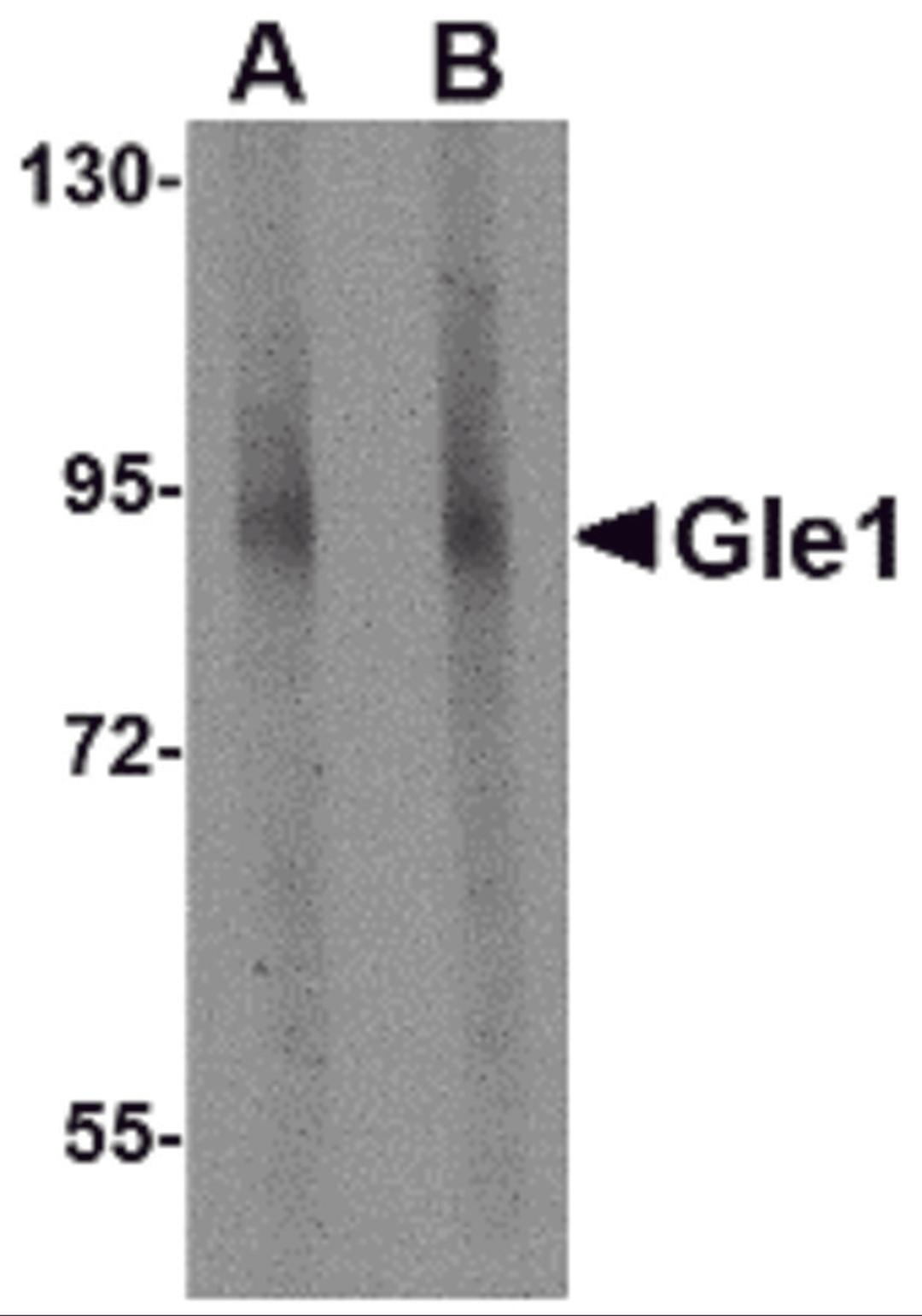 Western blot analysis of Gle1 in mouse brain tissue lysate with Gle1 antibody at (A) 1 and (B) 2 μg/mL.