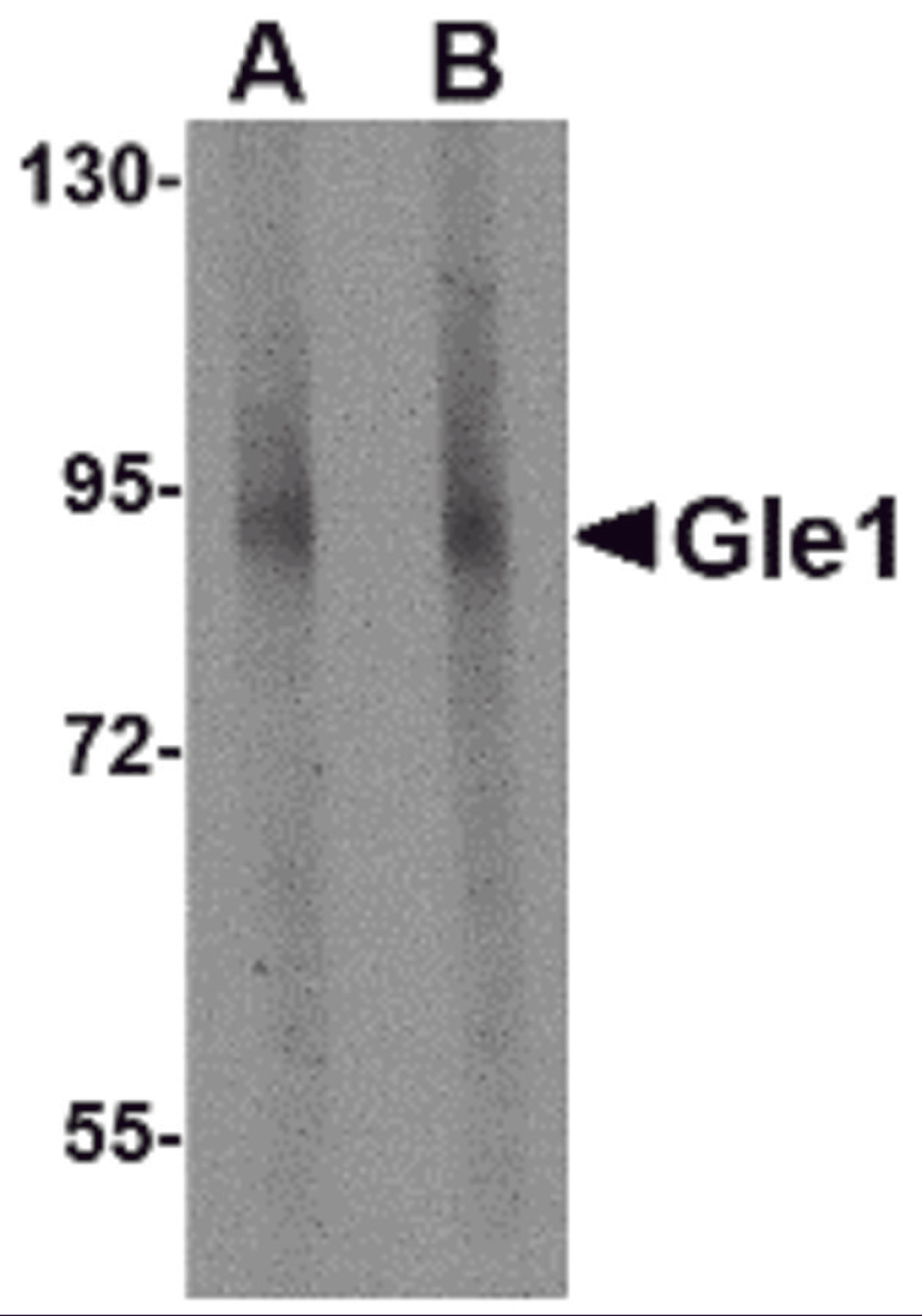 Western blot analysis of Gle1 in mouse brain tissue lysate with Gle1 antibody at (A) 1 and (B) 2 μg/mL.