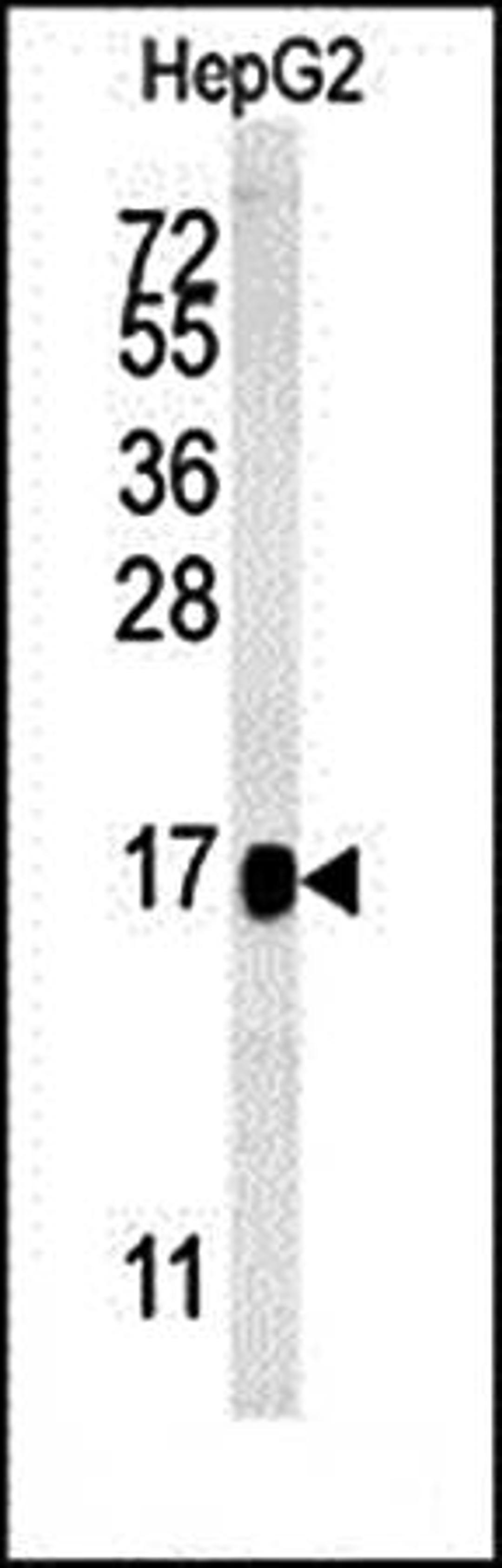 Western blot analysis of BLOC1S2 antibody in HepG2 cell line lysates 