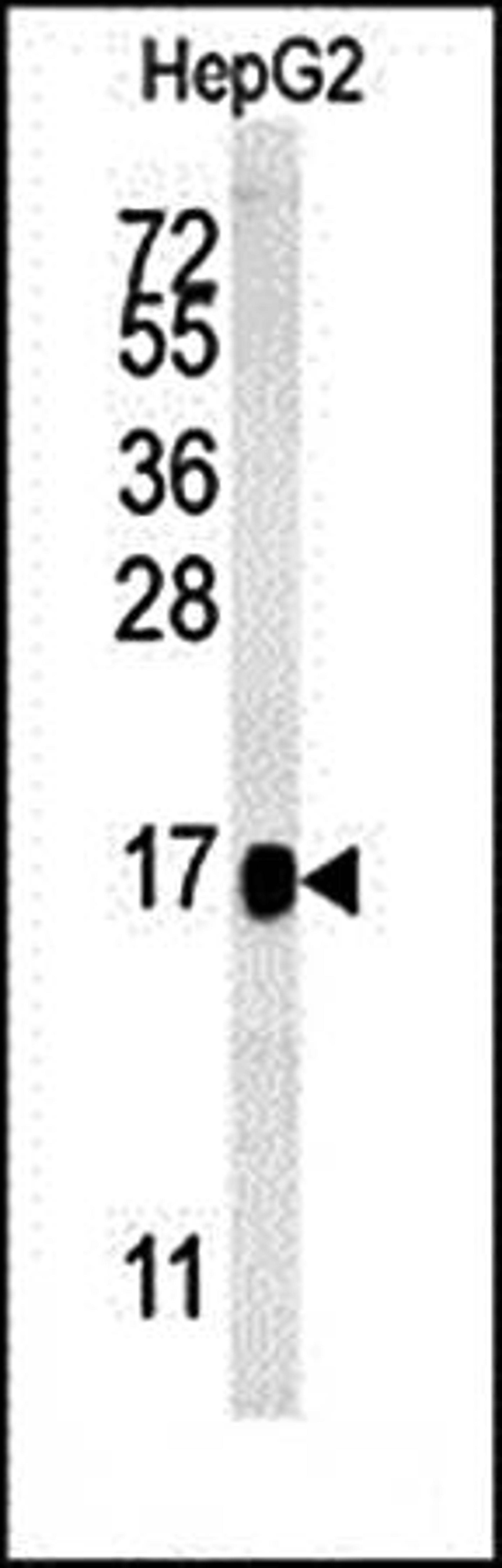Western blot analysis of BLOC1S2 antibody in HepG2 cell line lysates