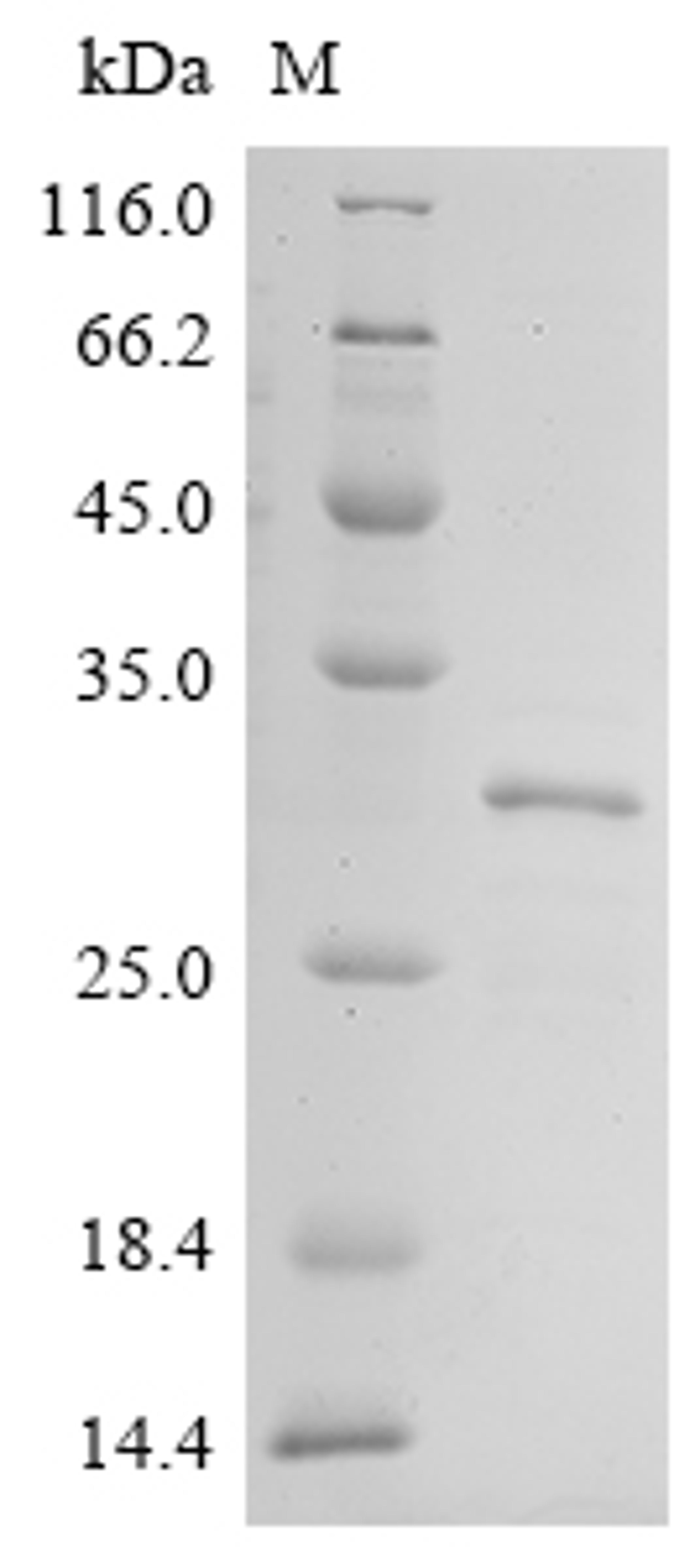 (Tris-Glycine gel) Discontinuous SDS-PAGE (reduced) with 5% enrichment gel and 15% separation gel.