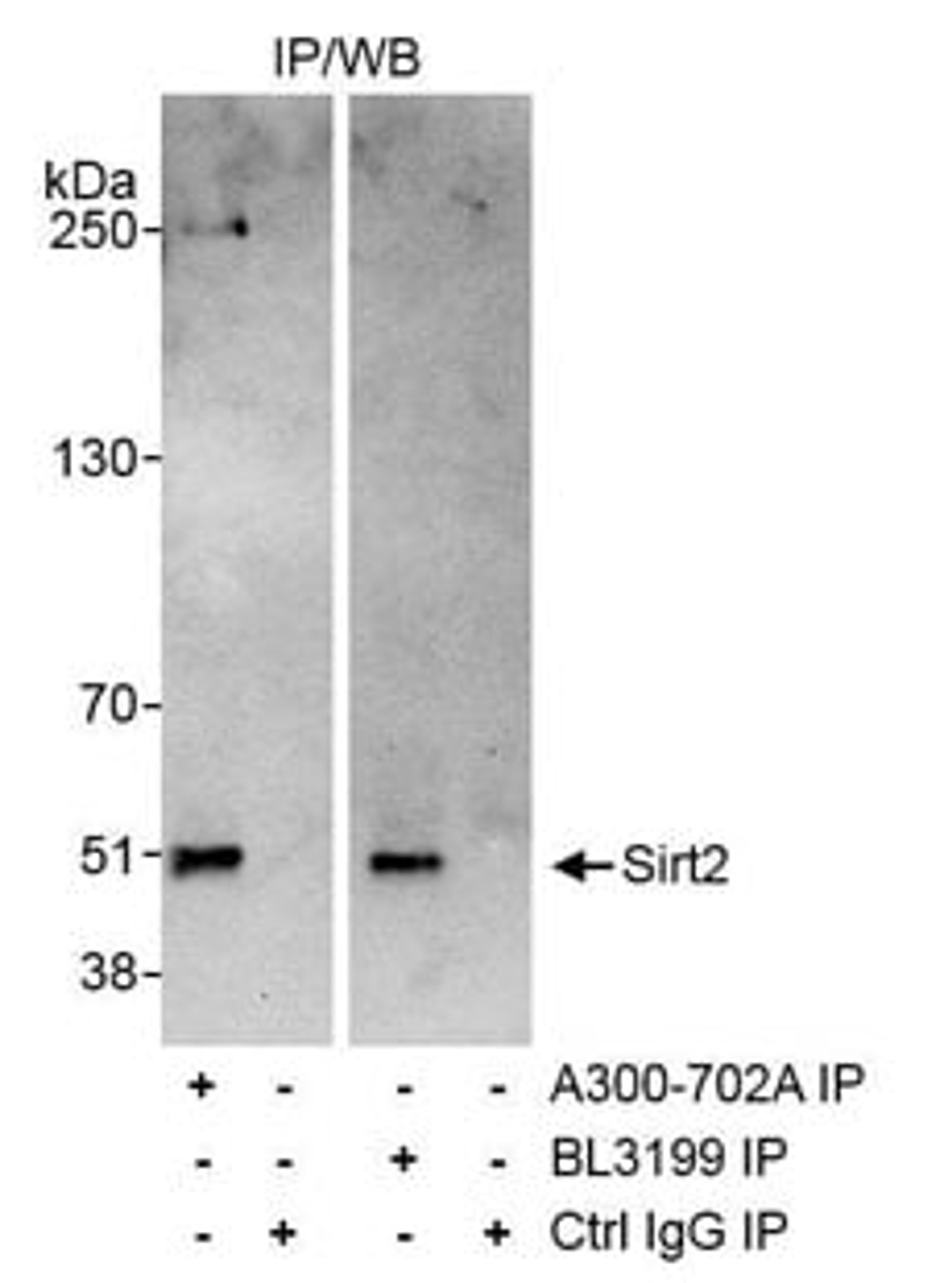 Detection of human Sirt2 by western blot of immunoprecipitates.