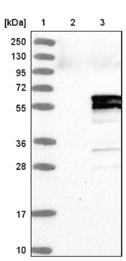 Western Blot: PIK3R3 Antibody [NBP1-87366] - Lane 1: Marker [kDa] 250, 130, 95, 72, 55, 36, 28, 17, 10<br/>Lane 2: Negative control (vector only transfected HEK293T lysate)<br/>Lane 3: Over-expression lysate (Co-expressed with a C-terminal myc-DDK tag (~3.1 kDa) in mammalian HEK293T cells, LY401202)