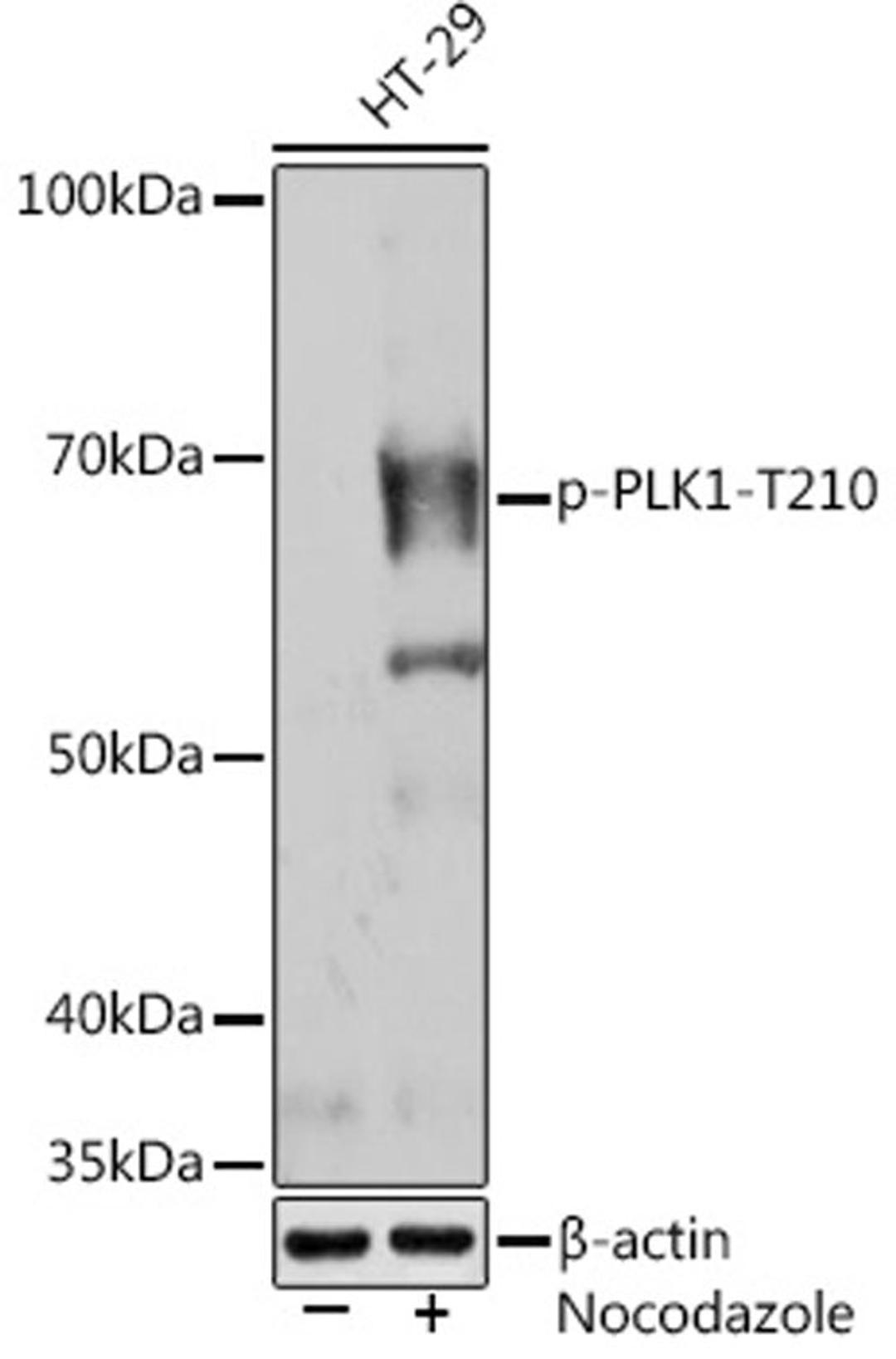 Western blot - Phospho-PLK1-T210 (AP1025)