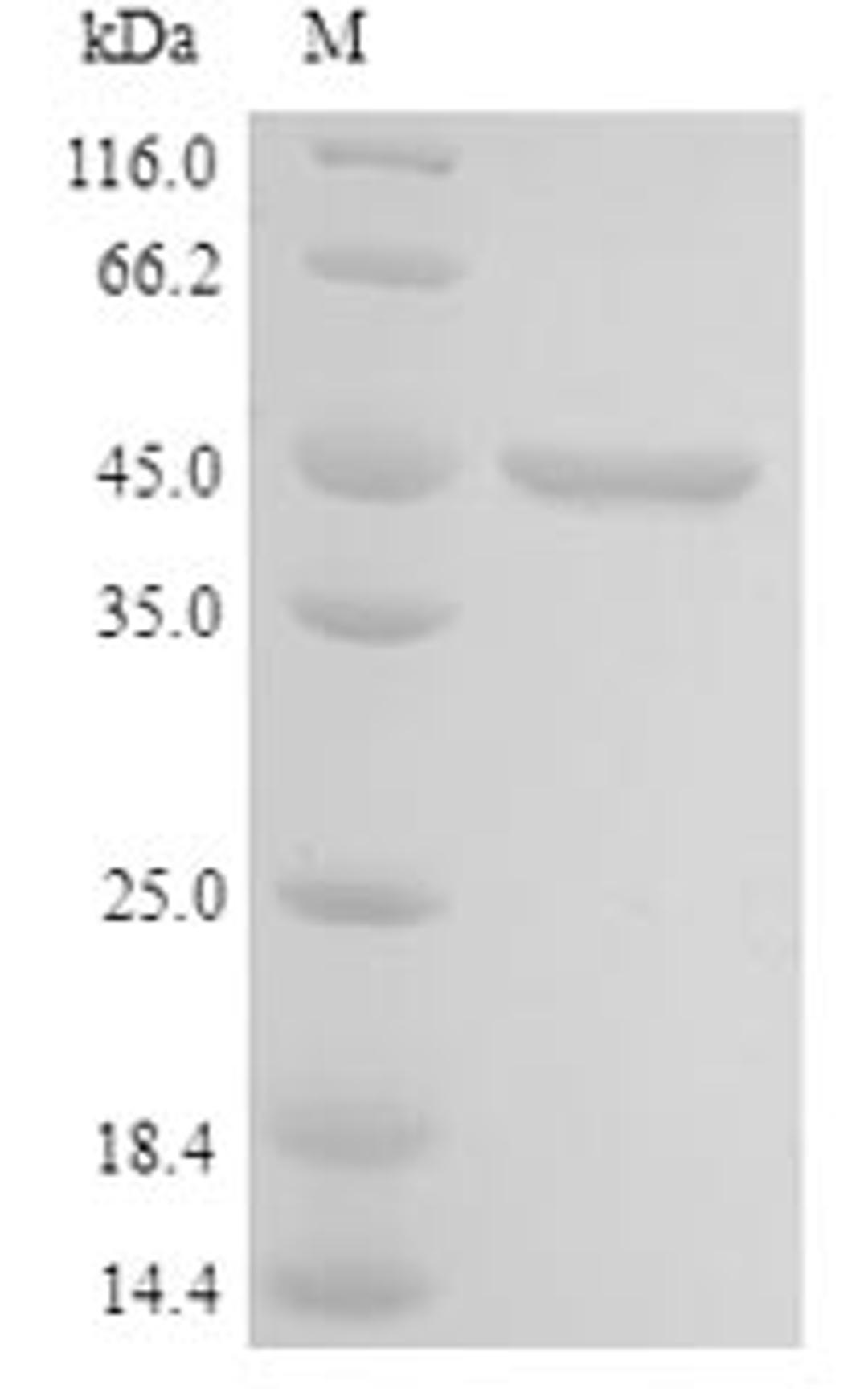 (Tris-Glycine gel) Discontinuous SDS-PAGE (reduced) with 5% enrichment gel and 15% separation gel.