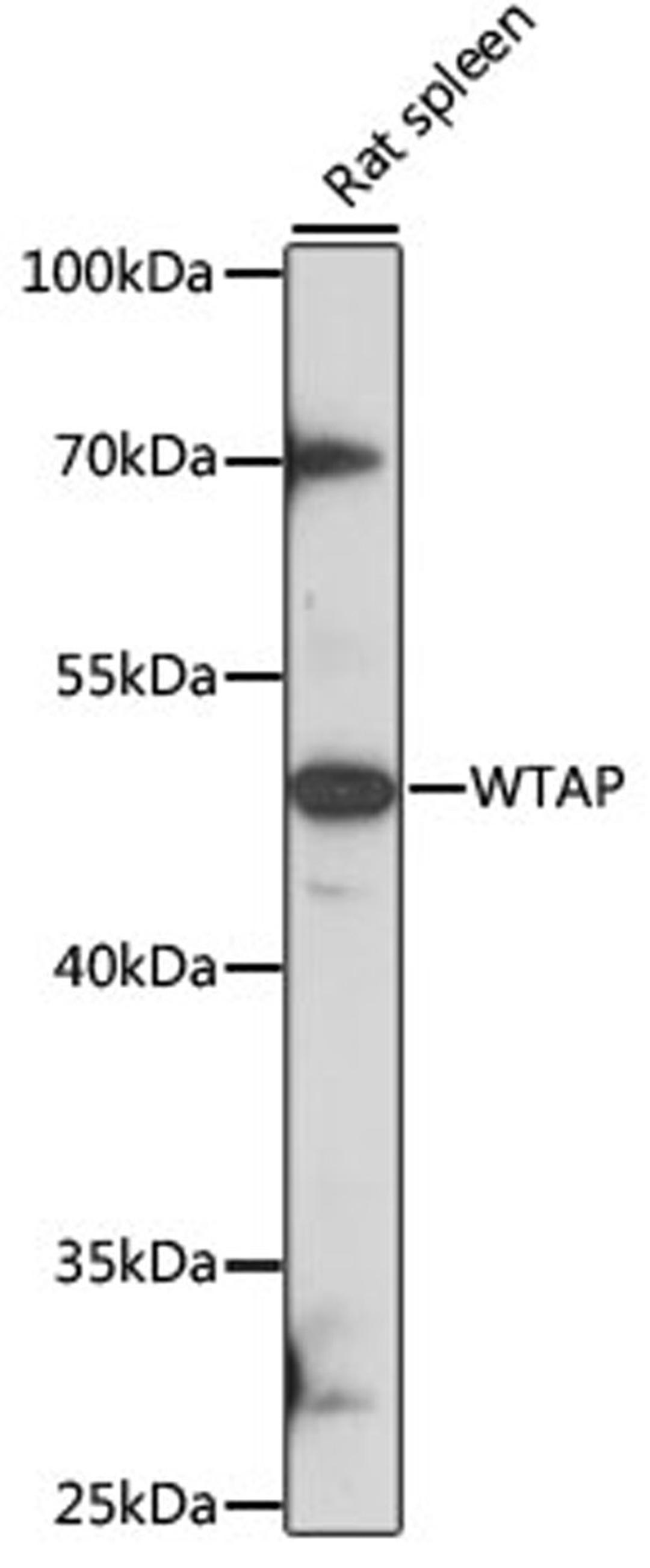 Western blot - WTAP antibody (A14695)