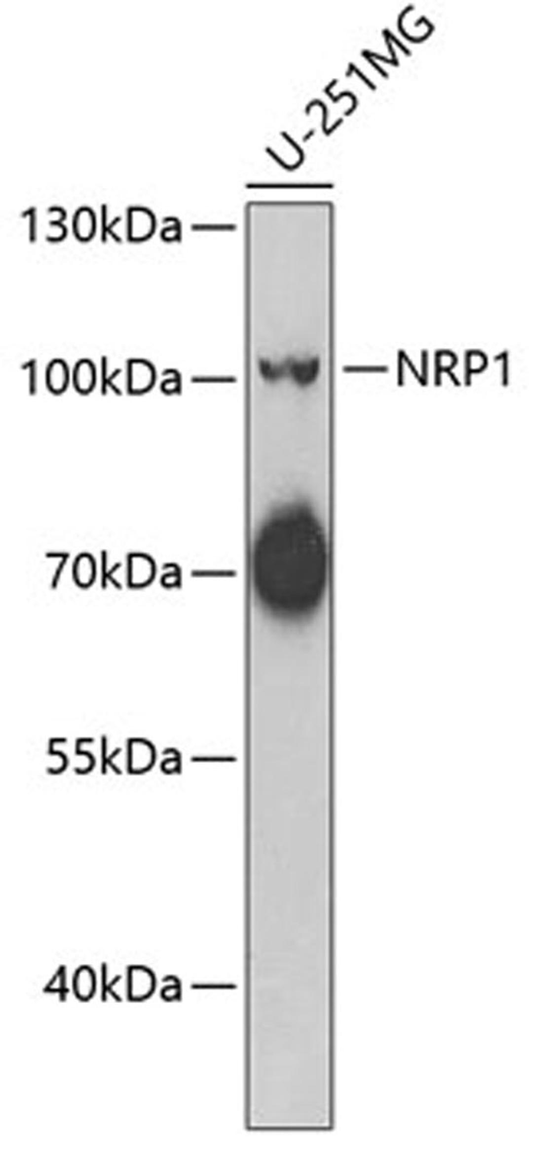 Western blot - NRP1 antibody (A6210)