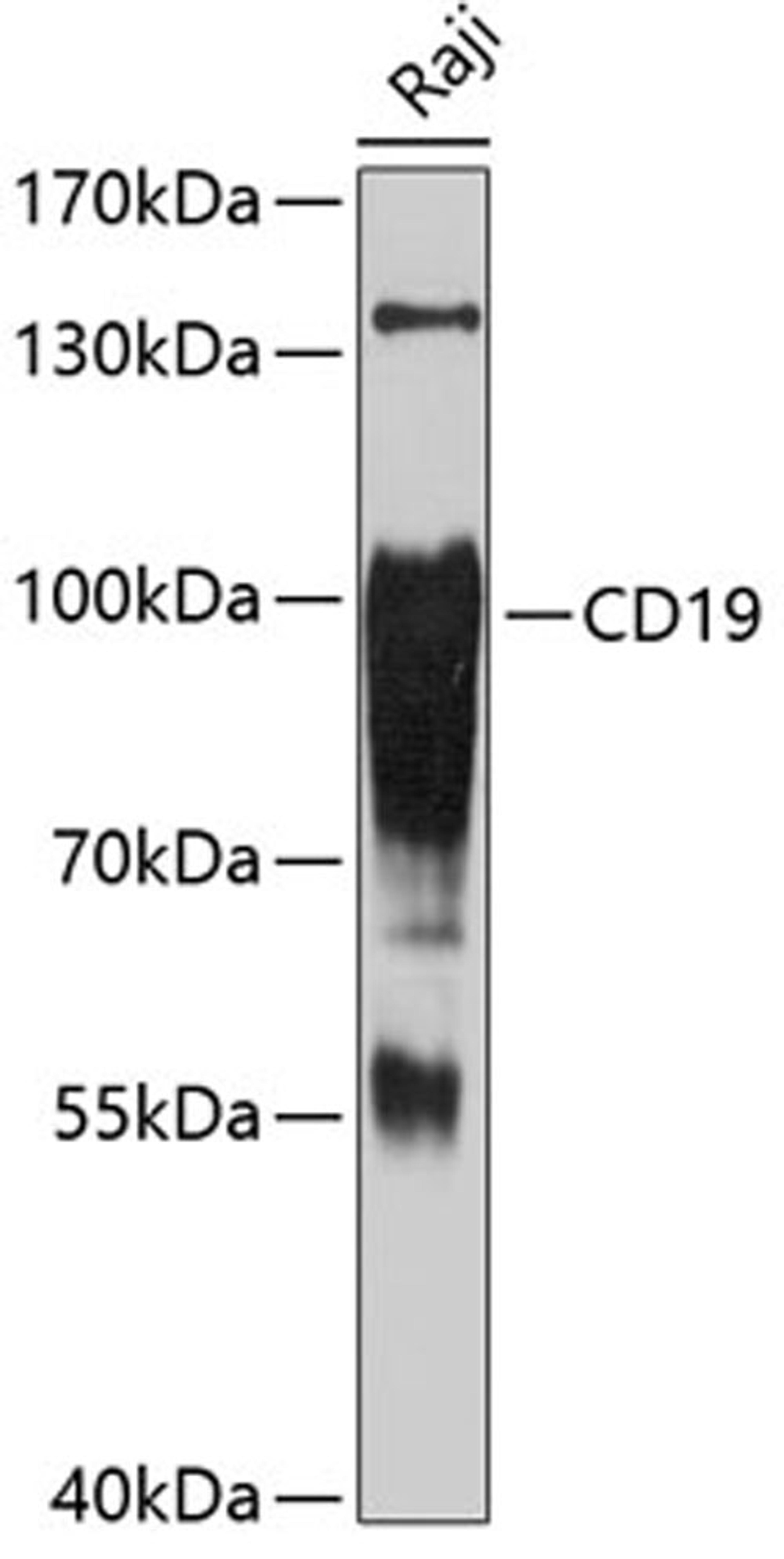 Western blot - CD19 Antibody (A2577)