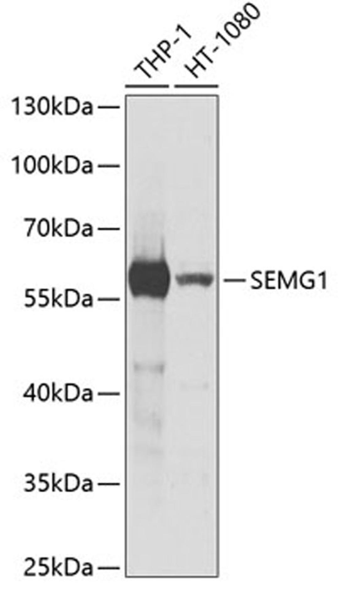 Western blot - SEMG1 antibody (A5487)