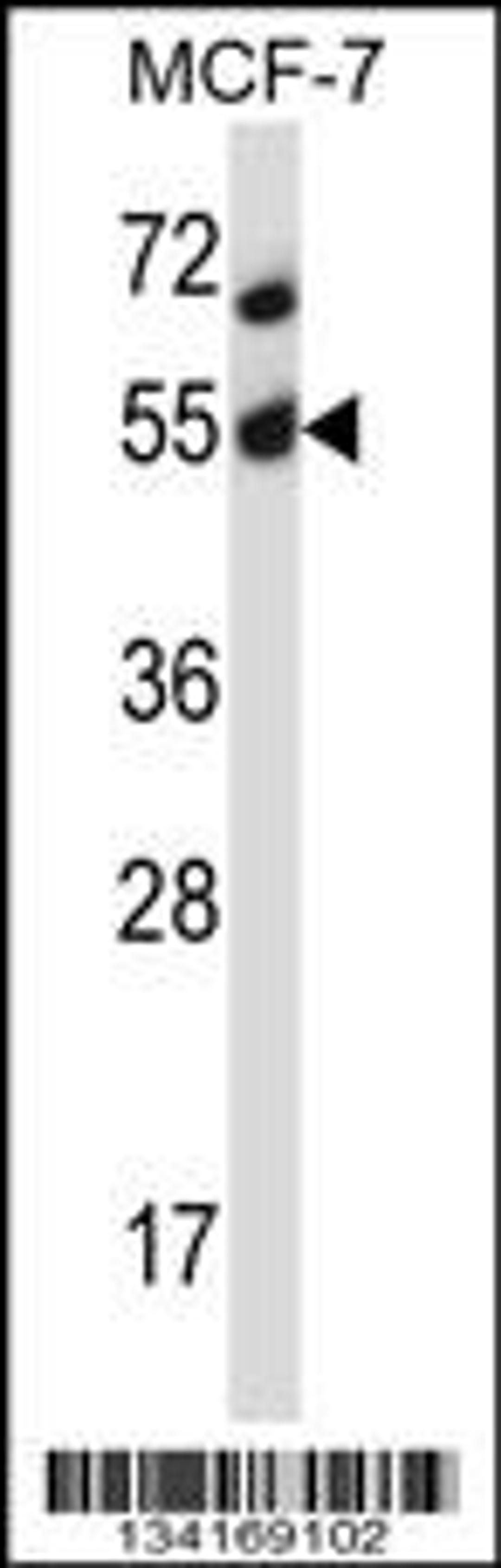 Western blot analysis in MCF-7 cell line lysates (35ug/lane).