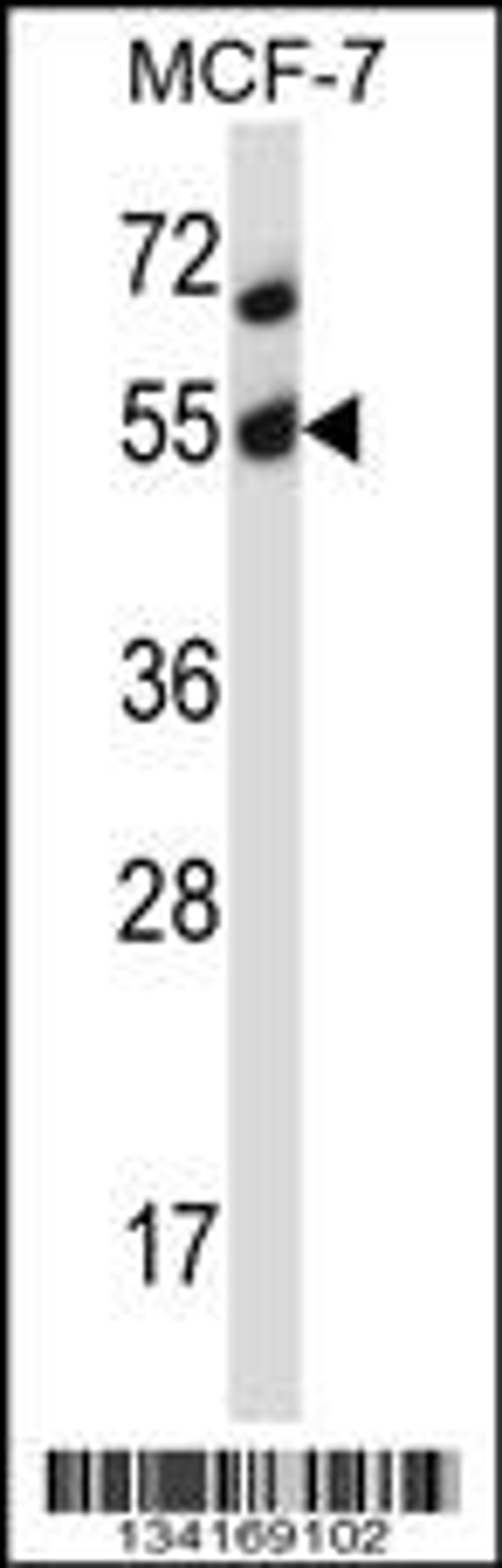 Western blot analysis in MCF-7 cell line lysates (35ug/lane).