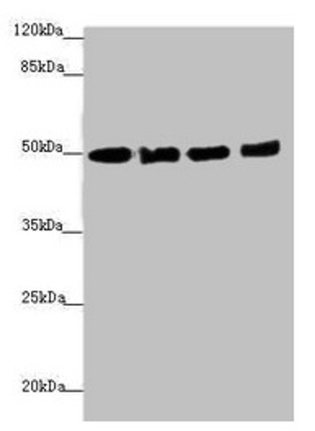Western blot. All lanes: EEF1A2 antibody at 1.46µg/ml. Lane 1: MCF-7 whole cell lysate. Lane 2: Hela whole cell lysate. Lane 3: Raji whole cell lysate. Lane 4: A431 whole cell lysate. Secondary. Goat polyclonal to rabbit IgG at 1/10000 dilution. Predicted band size: 50 kDa. Observed band size: 50 kDa