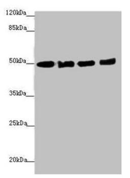 Western blot. All lanes: EEF1A2 antibody at 1.46µg/ml. Lane 1: MCF-7 whole cell lysate. Lane 2: Hela whole cell lysate. Lane 3: Raji whole cell lysate. Lane 4: A431 whole cell lysate. Secondary. Goat polyclonal to rabbit IgG at 1/10000 dilution. Predicted band size: 50 kDa. Observed band size: 50 kDa