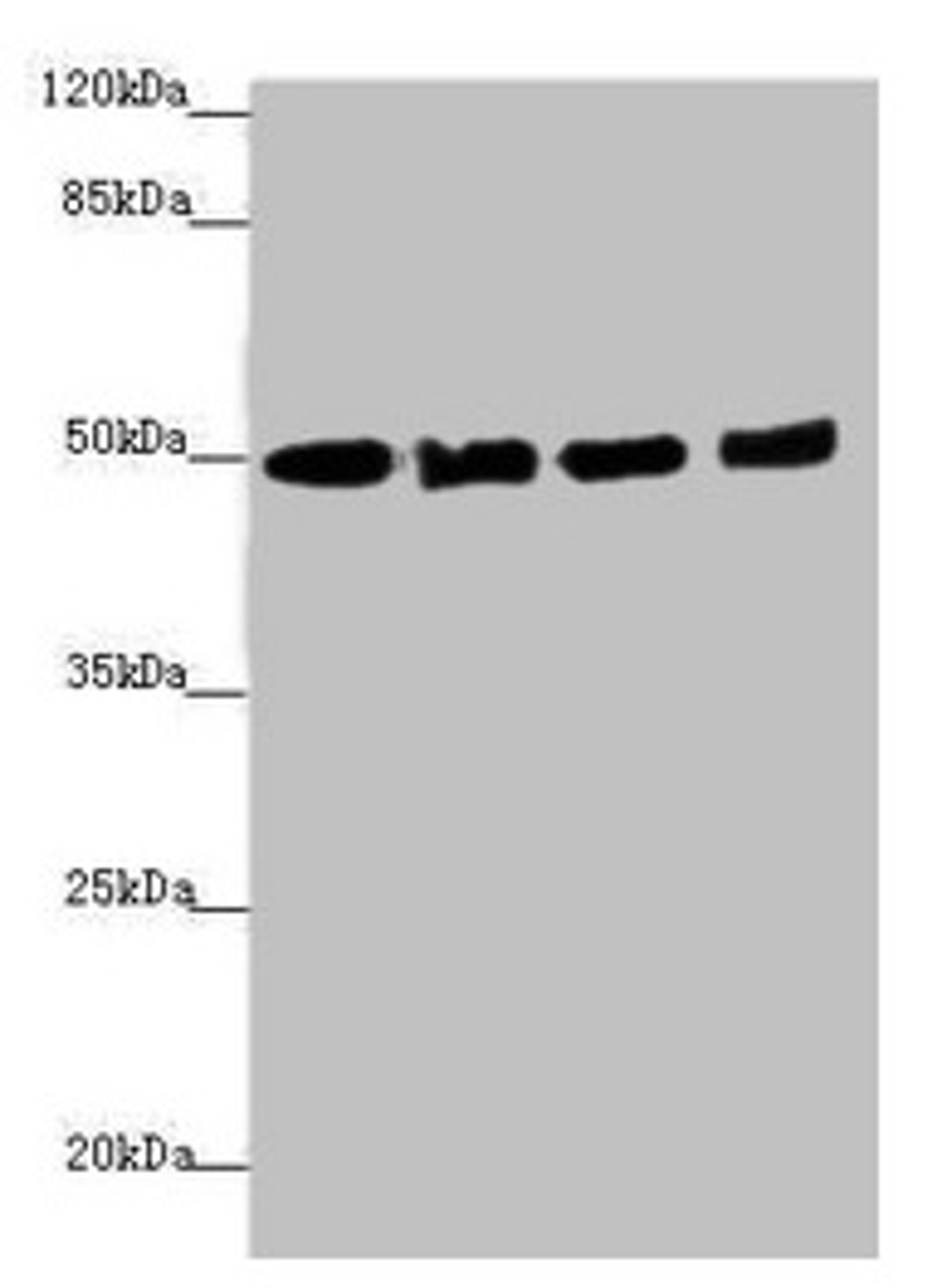 Western blot. All lanes: EEF1A2 antibody at 1.46µg/ml. Lane 1: MCF-7 whole cell lysate. Lane 2: Hela whole cell lysate. Lane 3: Raji whole cell lysate. Lane 4: A431 whole cell lysate. Secondary. Goat polyclonal to rabbit IgG at 1/10000 dilution. Predicted band size: 50 kDa. Observed band size: 50 kDa