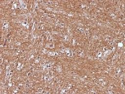 IHC testing of FFPE human cerebellum with NSE antibody (clone ENO2/1375). Required HIER: boil sections in 10mM citrate buffer, pH6, for 10-20 min.