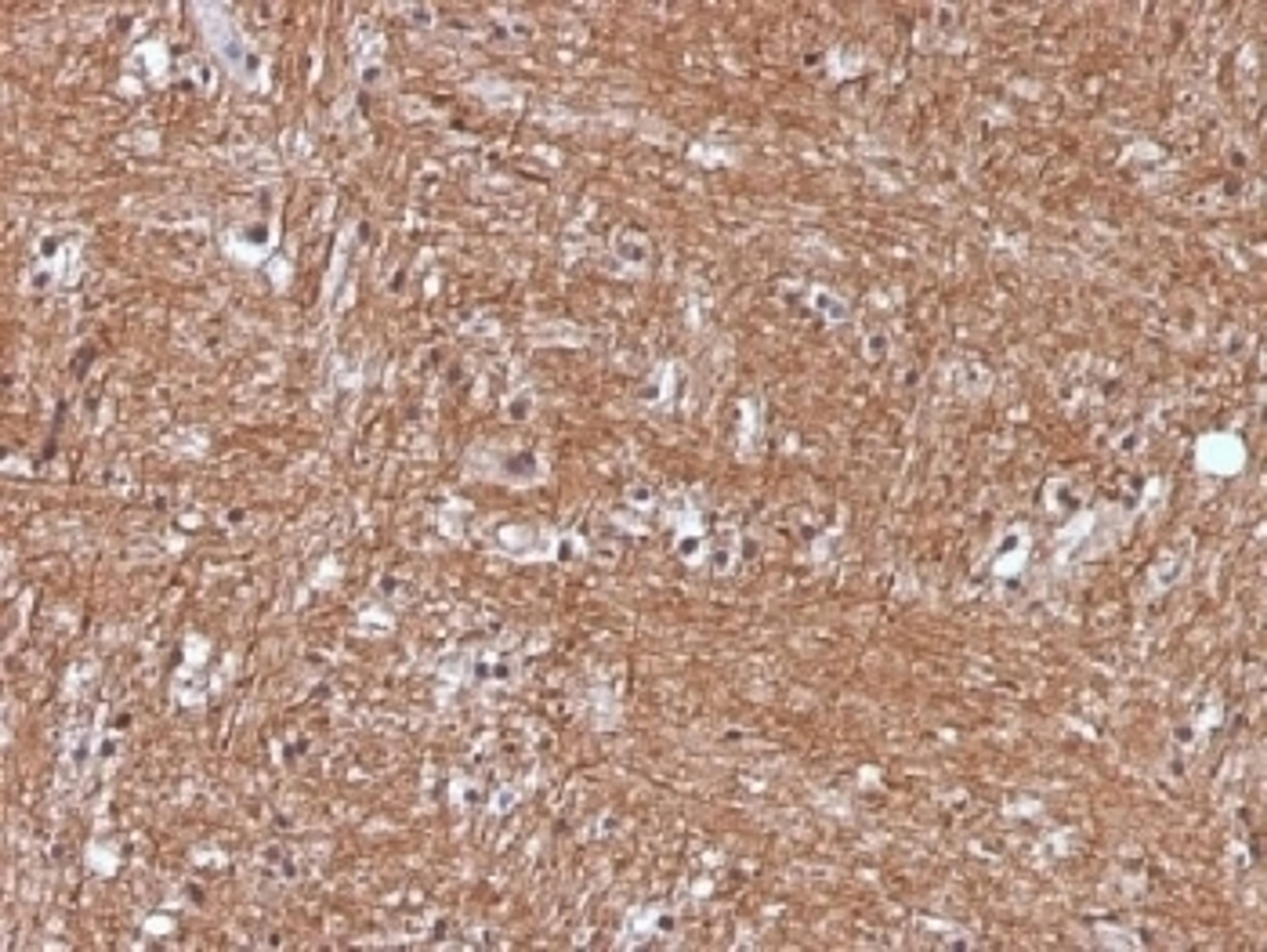 IHC testing of FFPE human cerebellum with NSE antibody (clone ENO2/1375). Required HIER: boil sections in 10mM citrate buffer, pH6, for 10-20 min.