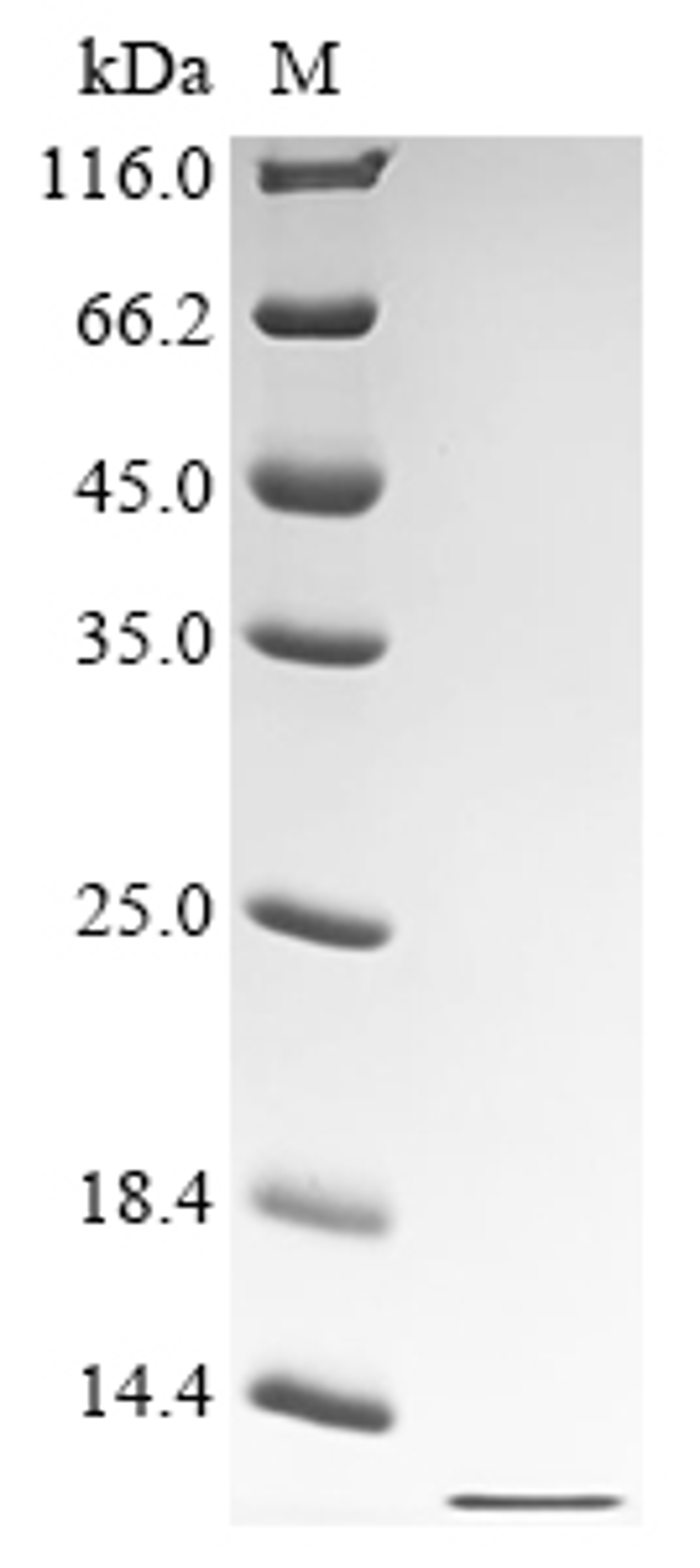 (Tris-Glycine gel) Discontinuous SDS-PAGE (reduced) with 5% enrichment gel and 15% separation gel.