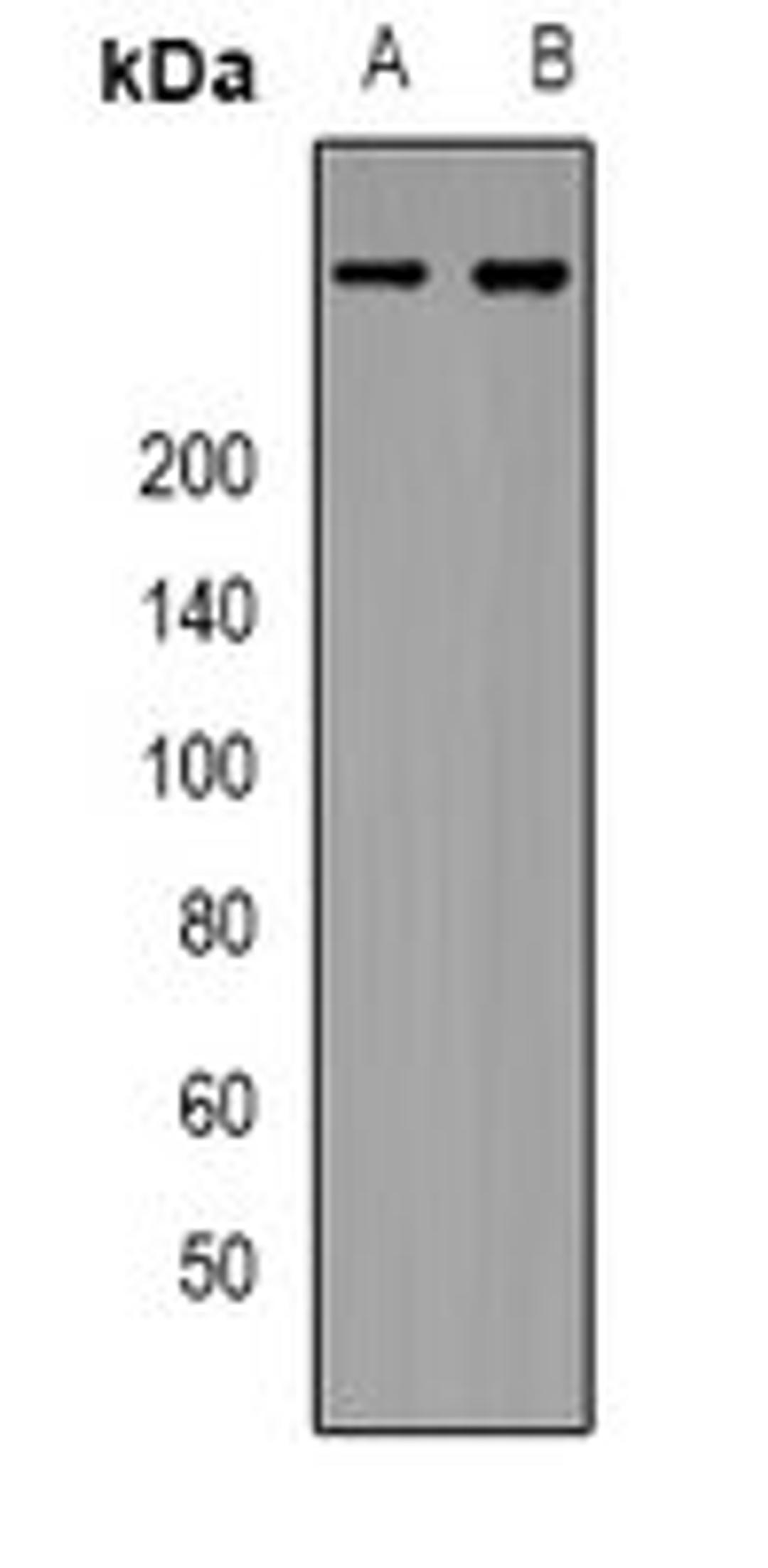 Western blot analysis of Hela (Lane 1), HEK293T (Lane 2) whole cell lysates using IP3R antibody