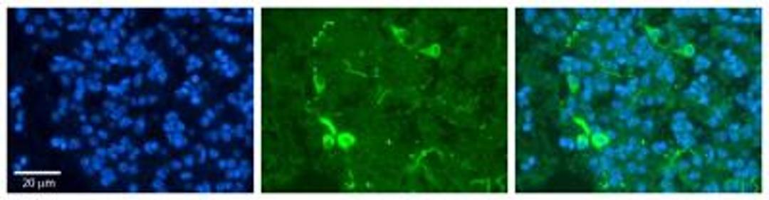 Immunocytochemistry/Immunofluorescence: Peroxiredoxin 2 Antibody [NBP1-54337] - Formalin Fixed Paraffin; Embedded Tissue: Human Pineal Tissue; Observed Staining: Cytoplasmic in cell bodies and processes of pinealocytes; Primary Antibody Concentration: 1:100