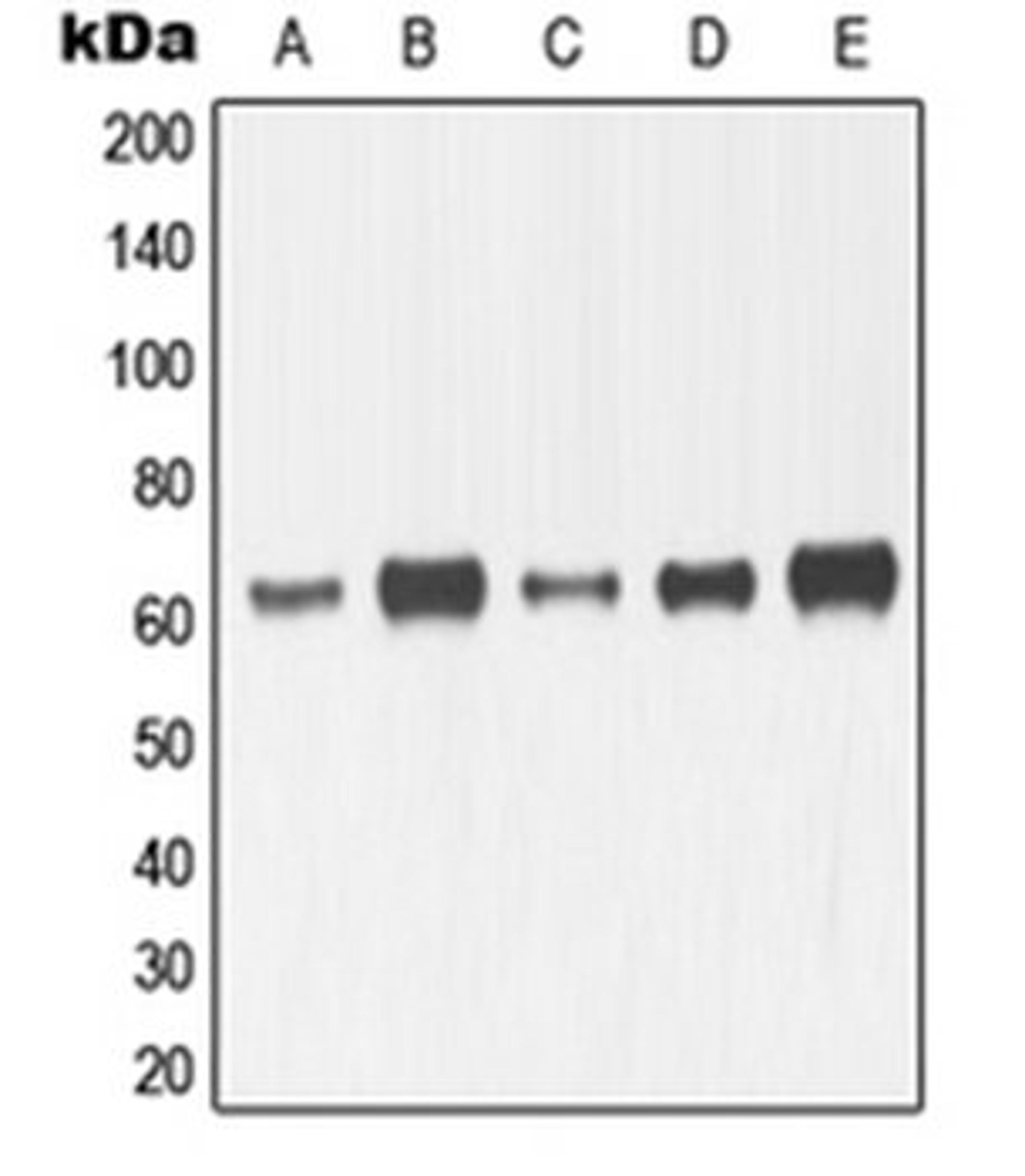 Western blot analysis of HeLa (Lane 1), HT1080 (Lane 2), MDMB23 (Lane 3), SP2/0 (Lane 4), mouse kidney (Lane 5), H9C2 (Lane 6) whole cell lysates using MMP14 antibody