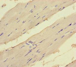 Immunohistochemistry of paraffin-embedded human skeletal muscle tissue using CSB-PA007409LA01HU at dilution of 1:100