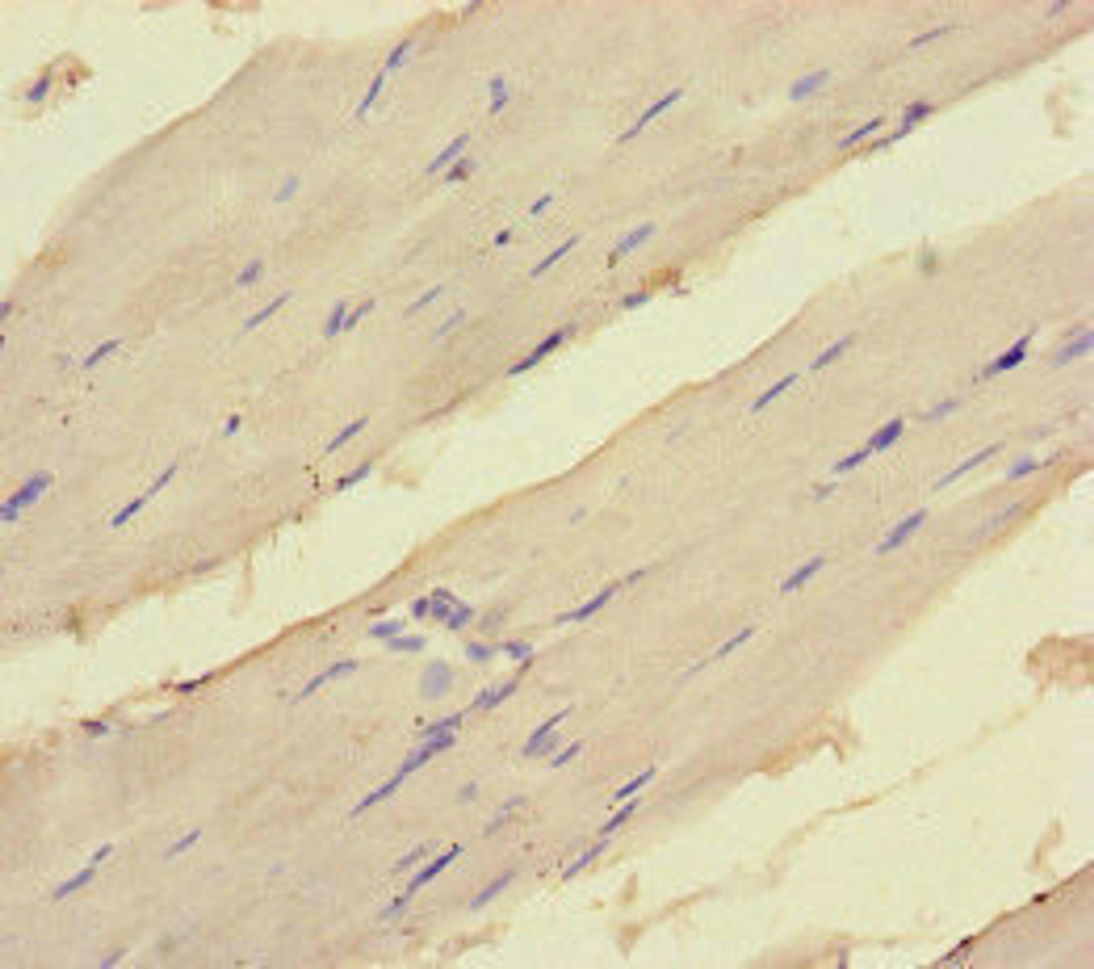 Immunohistochemistry of paraffin-embedded human skeletal muscle tissue using CSB-PA007409LA01HU at dilution of 1:100
