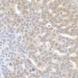 Detection of human UTX by immunohistochemistry.