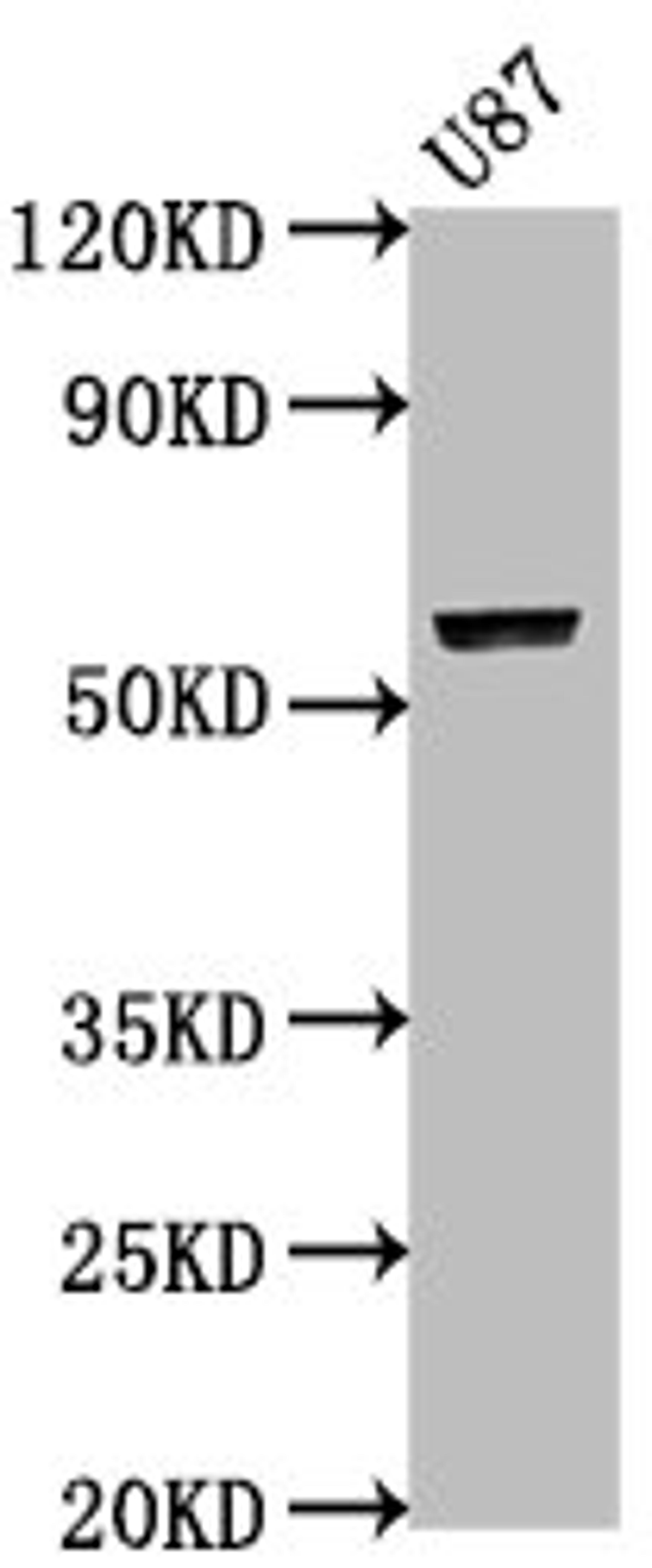 Western Blot. Positive WB detected in: U87 whole cell lysate. All lanes: PRAMEF17 antibody at 1:2000. Secondary. Goat polyclonal to rabbit IgG at 1/50000 dilution. Predicted band size: 55 kDa. Observed band size: 55 kDa. 