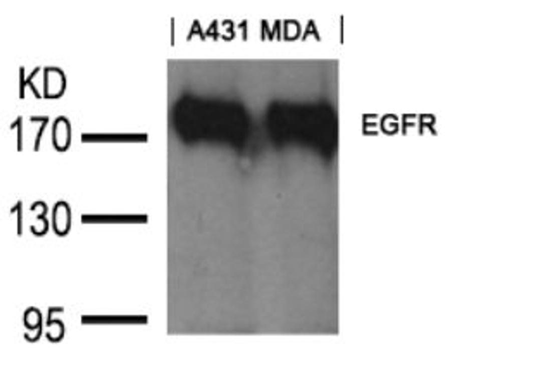 Western blot analysis of lysed extracts from A431 and MDA cells using EGFR (Ab-1197) goat polyclonal Antibody.