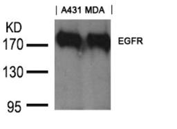 Western blot analysis of lysed extracts from A431 and MDA cells using EGFR (Ab-1197) goat polyclonal Antibody.