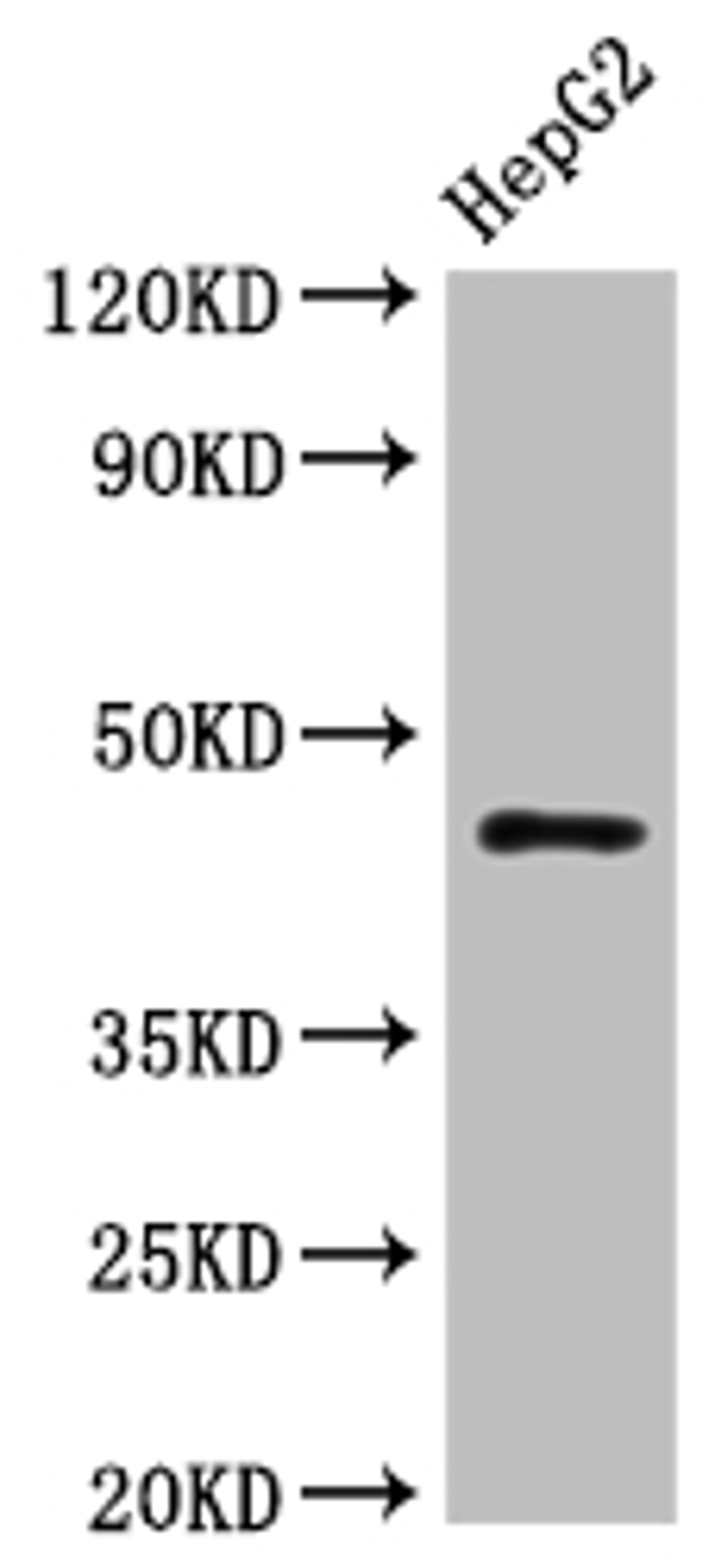 Western Blot. Positive WB detected in: HepG2 whole cell lysate. All lanes: HLA-B antibody at 1:1000. Secondary. Goat polyclonal to rabbit IgG at 1/50000 dilution. Predicted band size: 41 kDa. Observed band size: 45 kDa. 