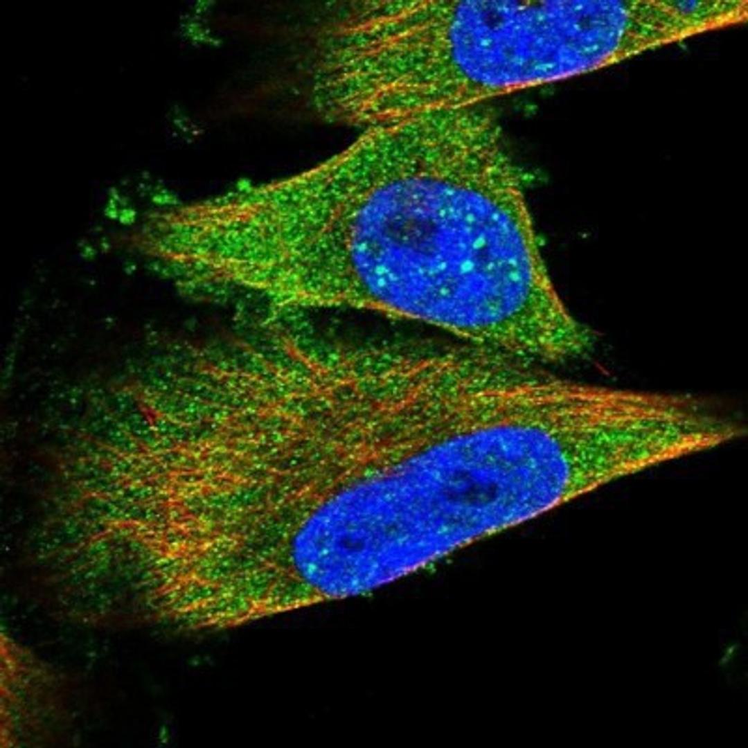 Immunocytochemistry/Immunofluorescence: TEL2 Antibody [NBP1-81761] - Staining of human cell line U-251 MG shows positivity in nucleus & cytoplasm.