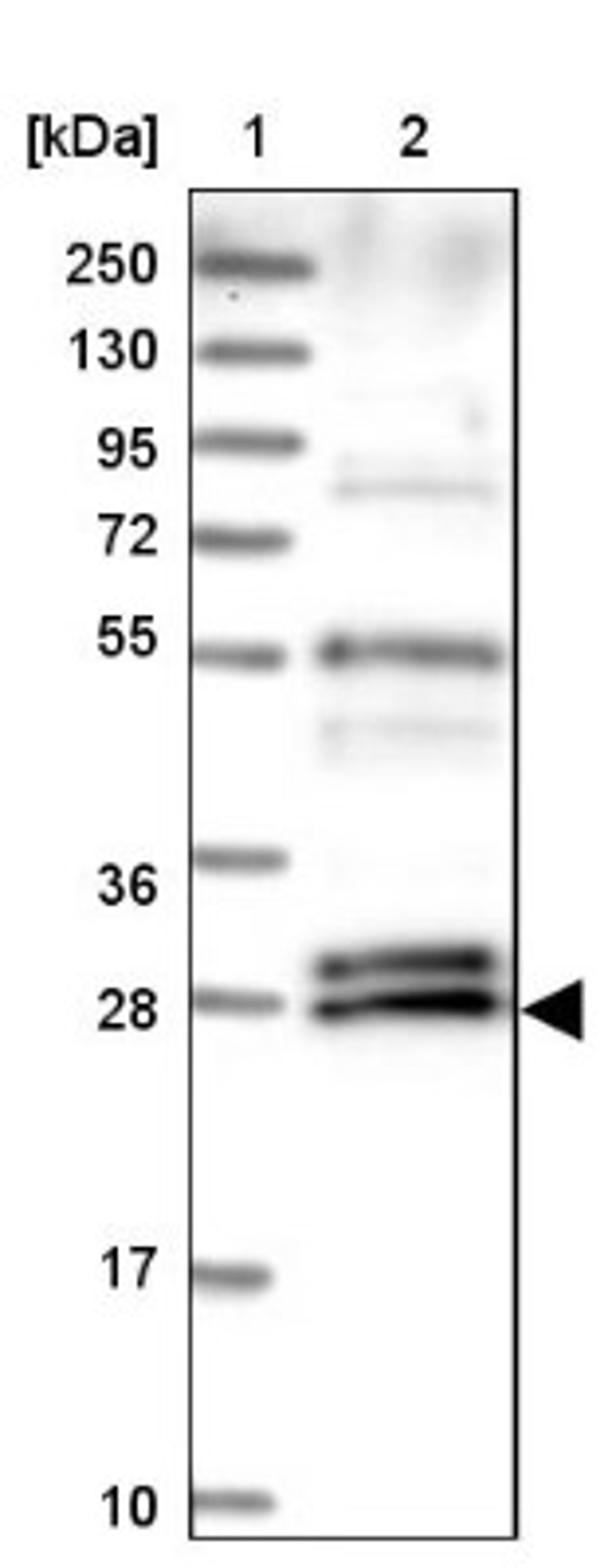 Western Blot: C10orf67 Antibody [NBP1-81068] - Lane 1: Marker [kDa] 250, 130, 95, 72, 55, 36, 28, 17, 10<br/>Lane 2: Human cell line RT-4