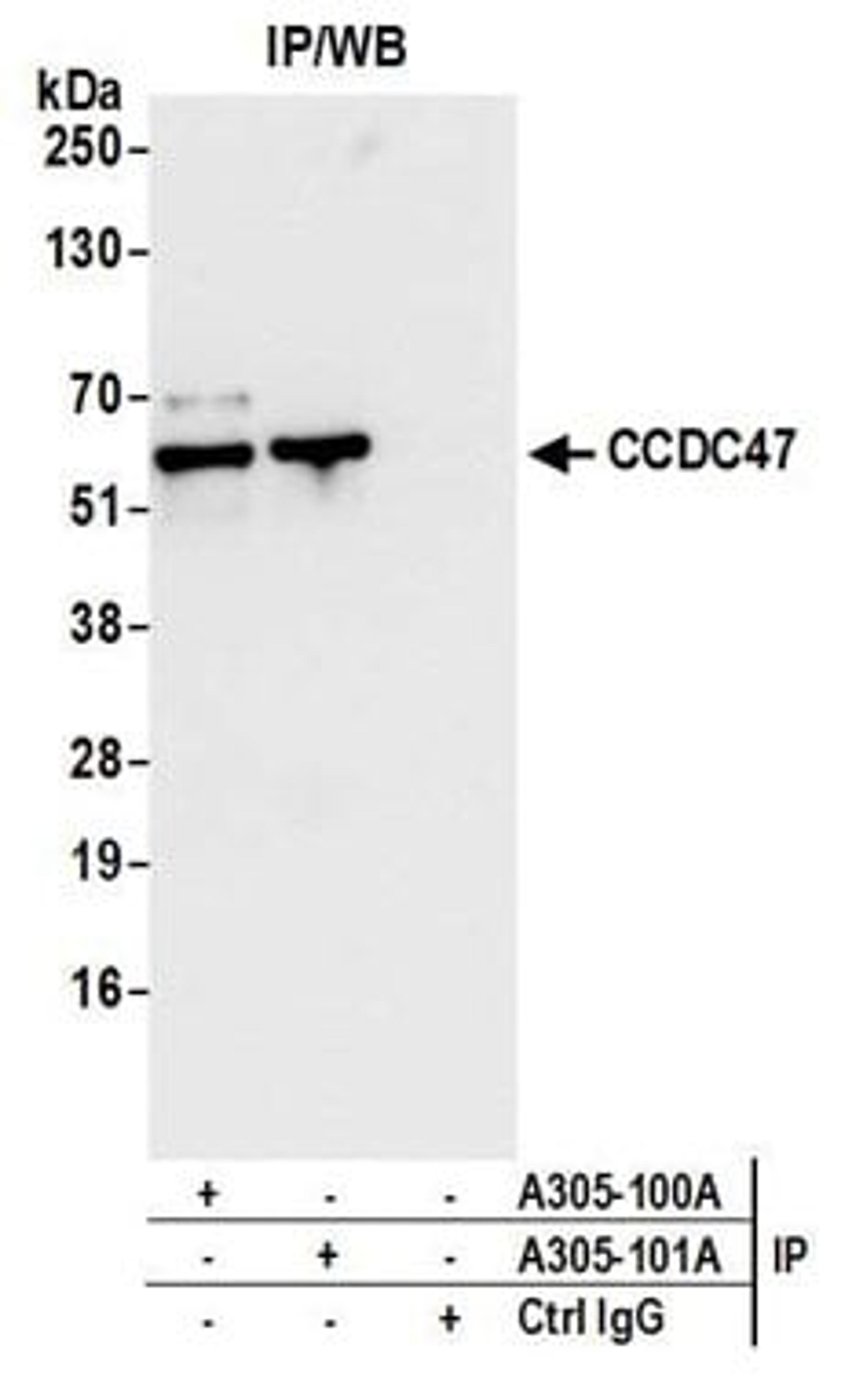 Detection of human CCDC47 by western blot of immunoprecipitates.