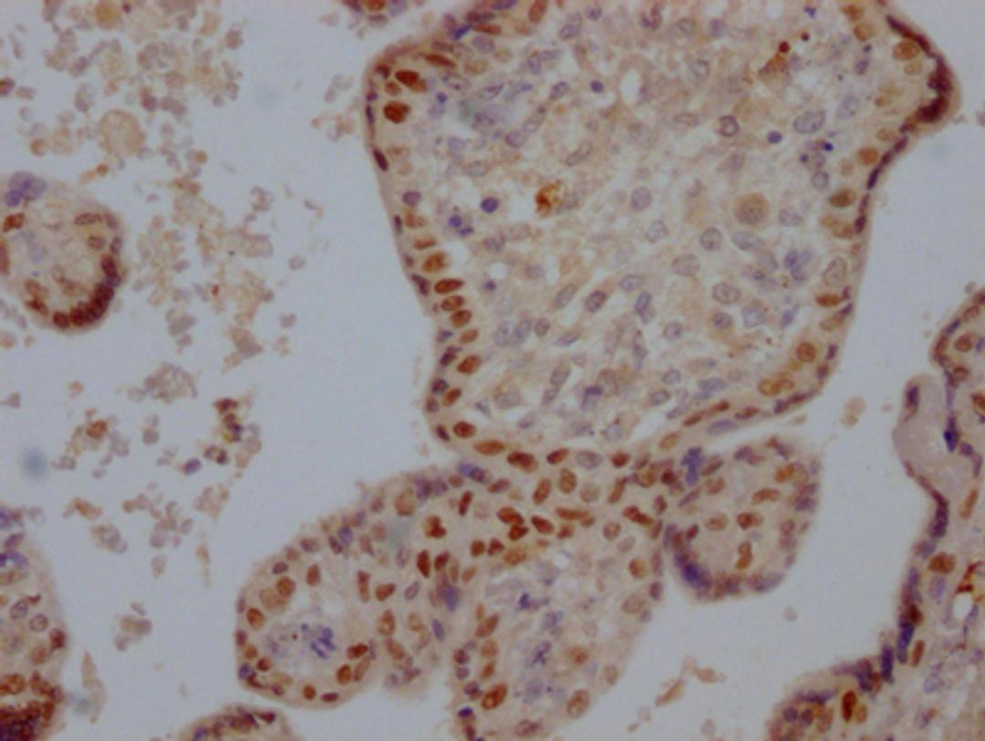 IHC image of CSB-RA160202A0HU diluted at 1:100 and staining in paraffin-embedded human placenta tissue performed on a Leica BondTM system. After dewaxing and hydration, antigen retrieval was mediated by high pressure in a citrate buffer (pH 6.0). Section was blocked with 10% normal goat serum 30min at RT. Then primary antibody (1% BSA) was incubated at 4℃ overnight. The primary is detected by a Goat anti-rabbit IgG polymer labeled by HRP and visualized using 0.05% DAB.