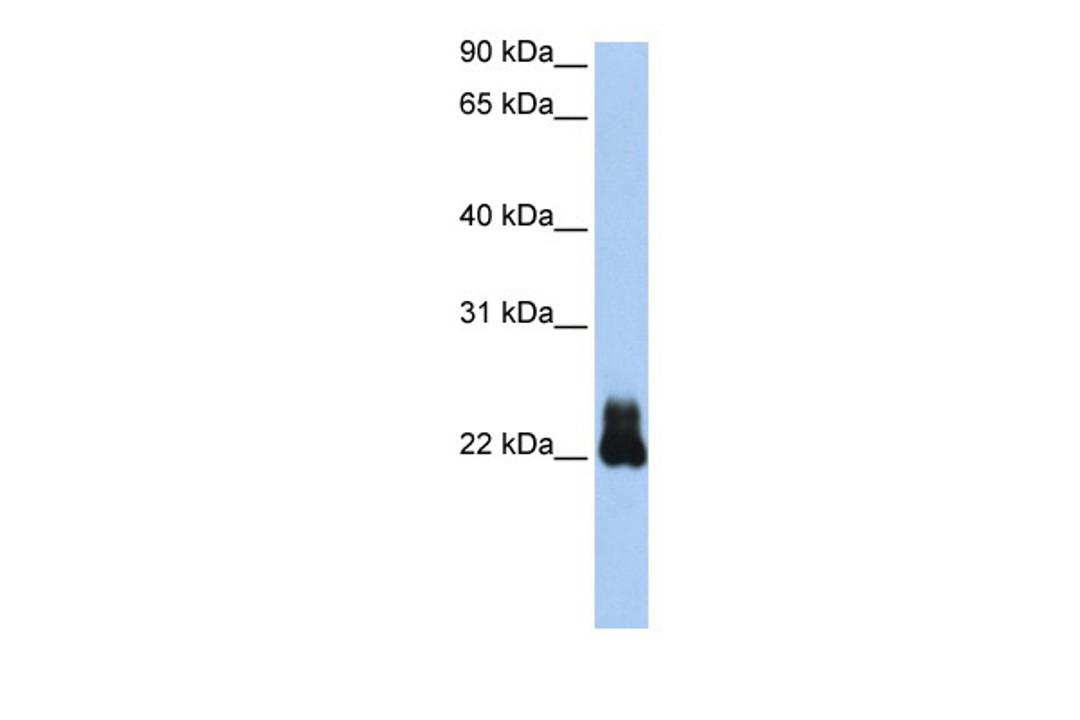 Antibody used in WB on Transfected 293T at 0.2-1 ug/ml.