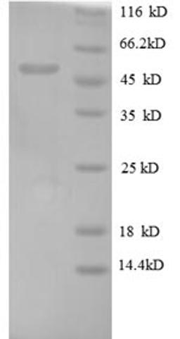 (Tris-Glycine gel) Discontinuous SDS-PAGE (reduced) with 5% enrichment gel and 15% separation gel.