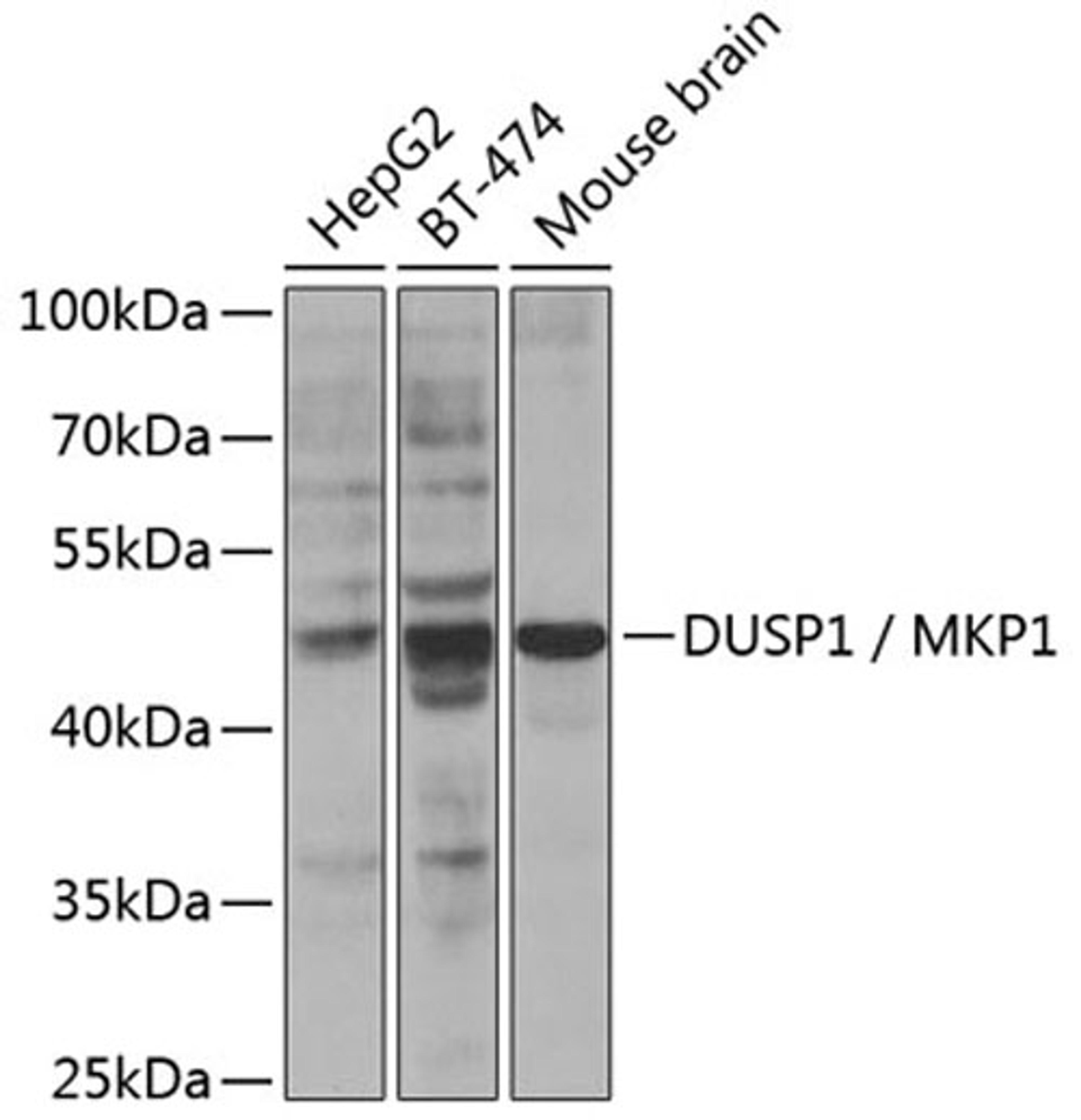 Western blot - DUSP1 / MKP1 Antibody (A2919)