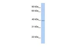 Antibody used in WB on Human Muscle at 0.2-1 ug/ml.