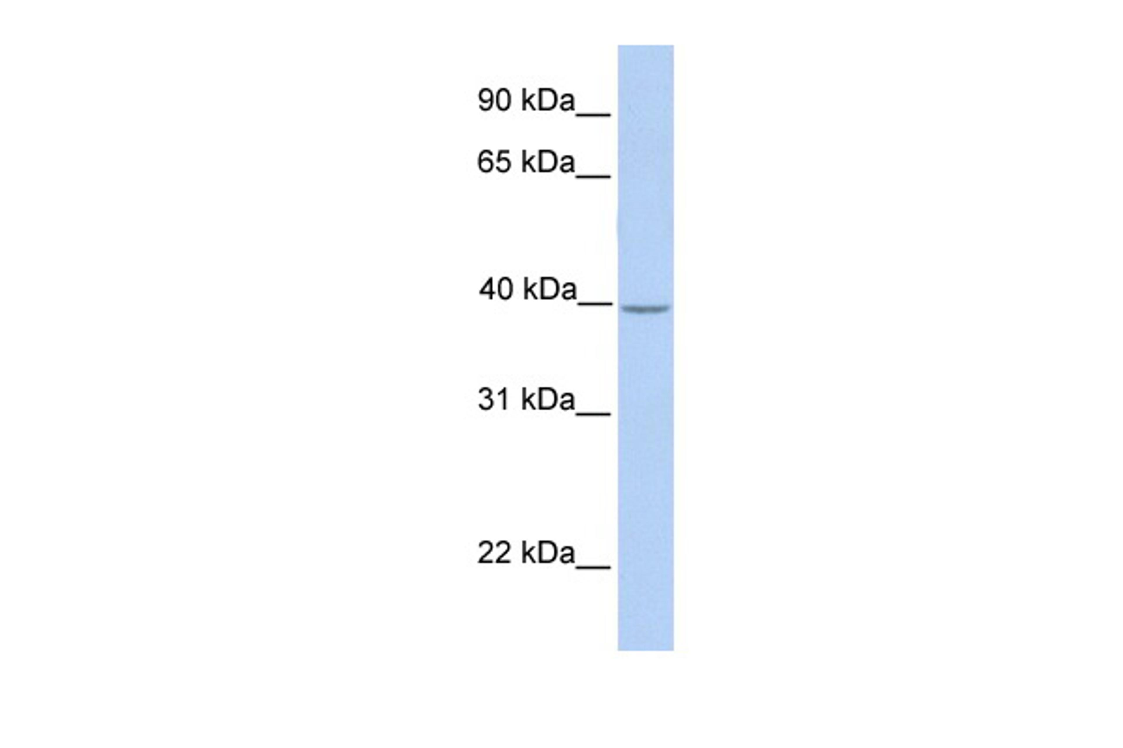 Antibody used in WB on Human Muscle at 0.2-1 ug/ml.