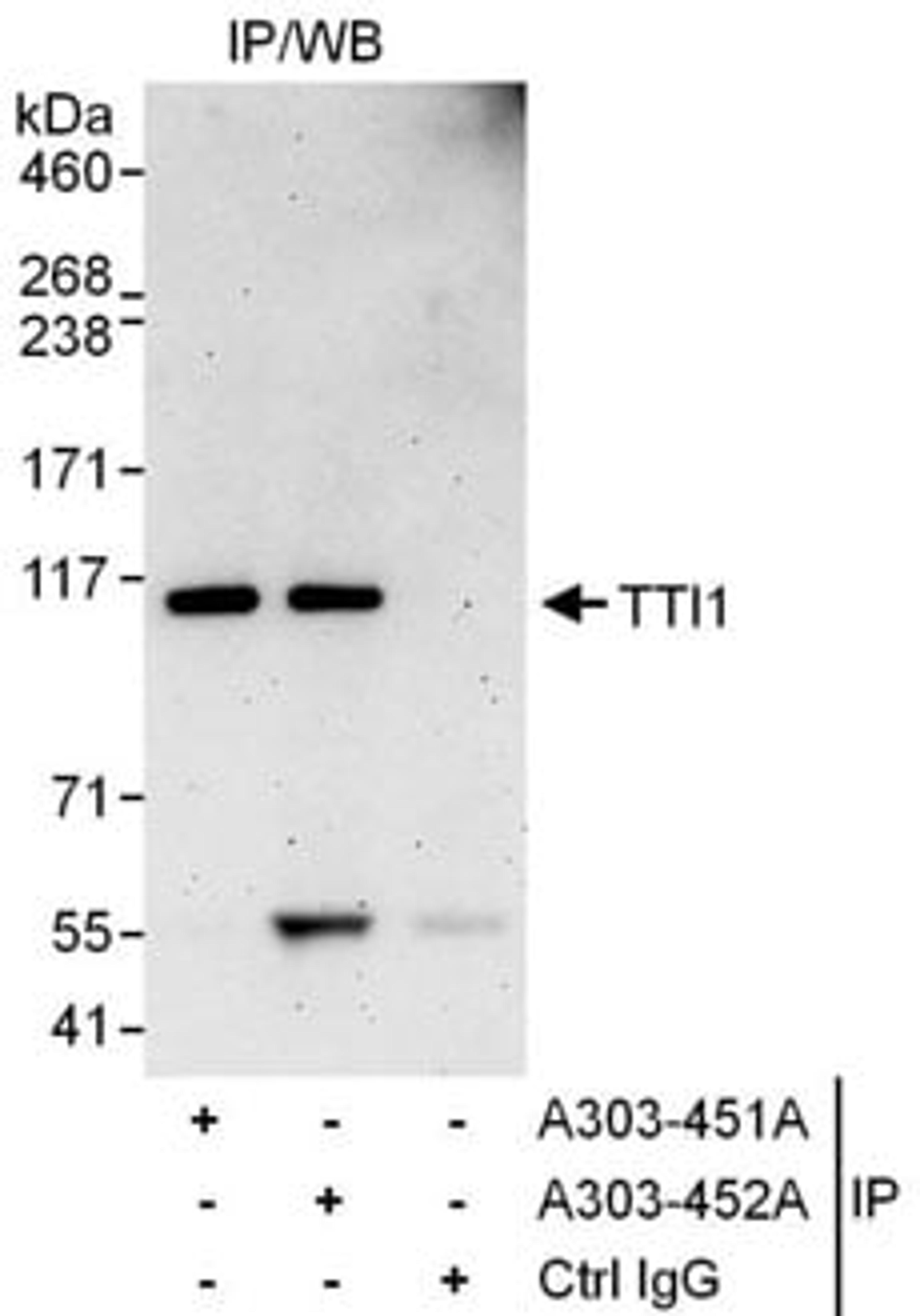 Detection of human TTI1 by western blot of immunoprecipitates.