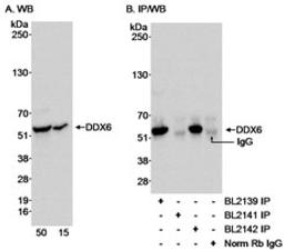 Detection of human DDX6 by western blot and immunoprecipitation.